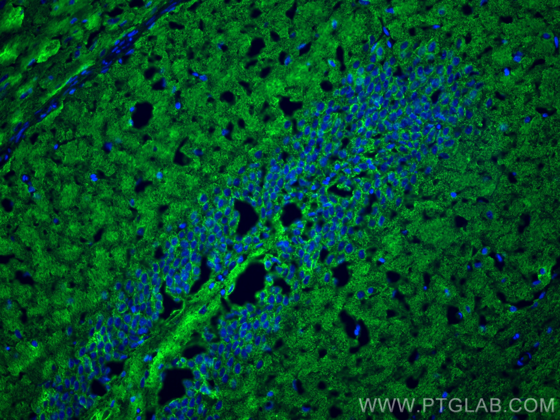 Immunofluorescence (IF) / fluorescent staining of rat brain tissue using Synaptophysin Monoclonal antibody (67864-1-Ig)