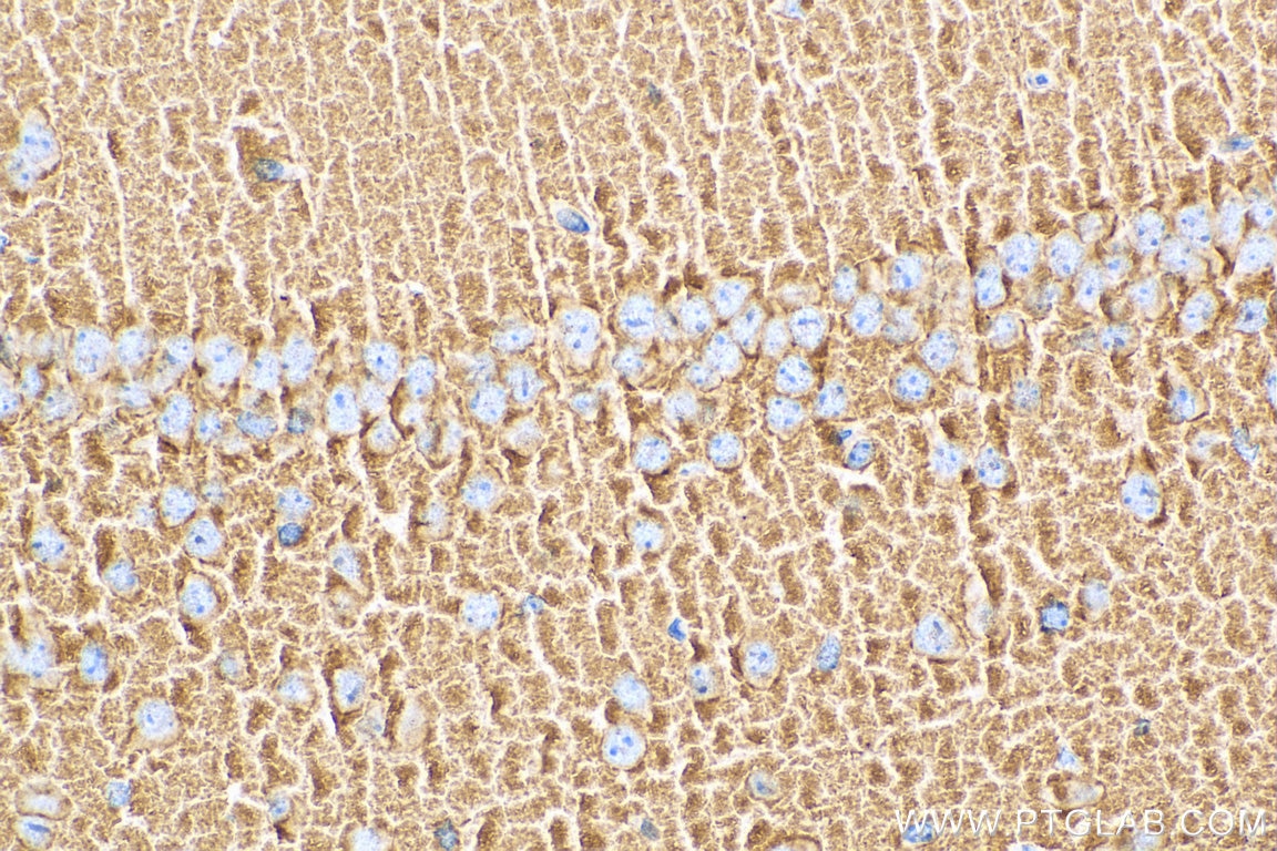 Immunohistochemistry (IHC) staining of mouse brain tissue using Synaptophysin Monoclonal antibody (67864-1-Ig)