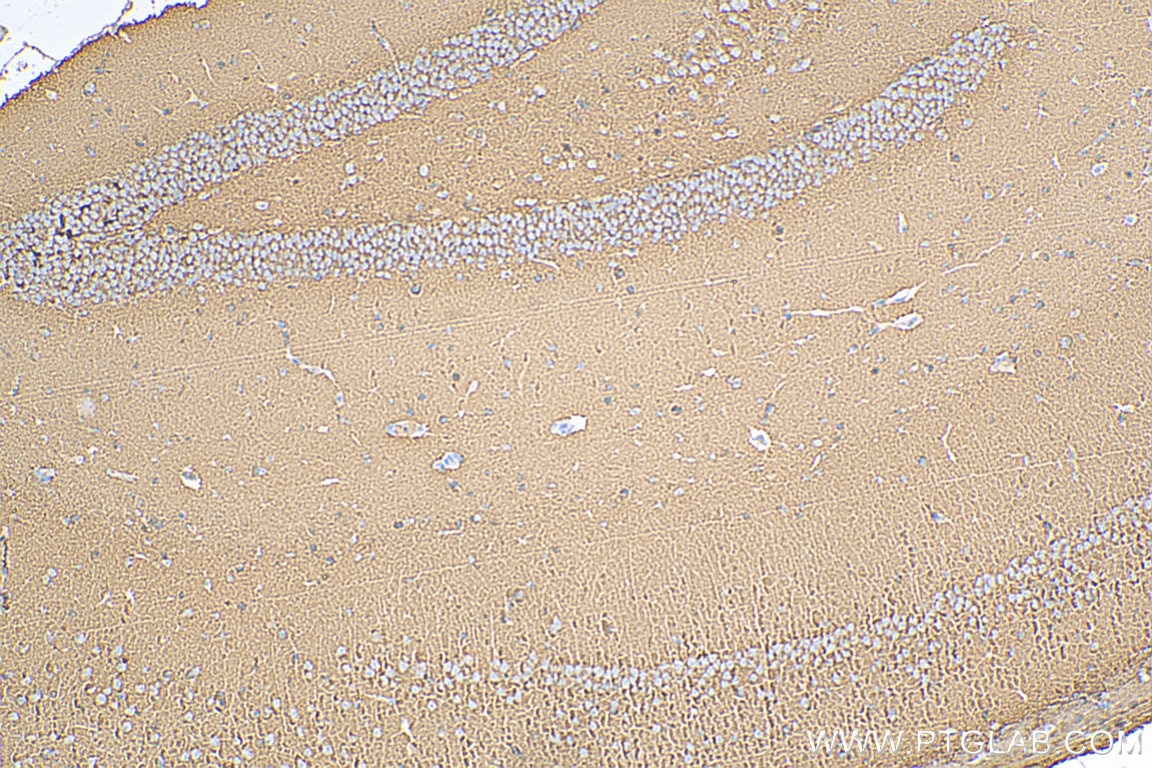 Immunohistochemistry (IHC) staining of mouse brain tissue using Synaptophysin Monoclonal antibody (67864-1-Ig)