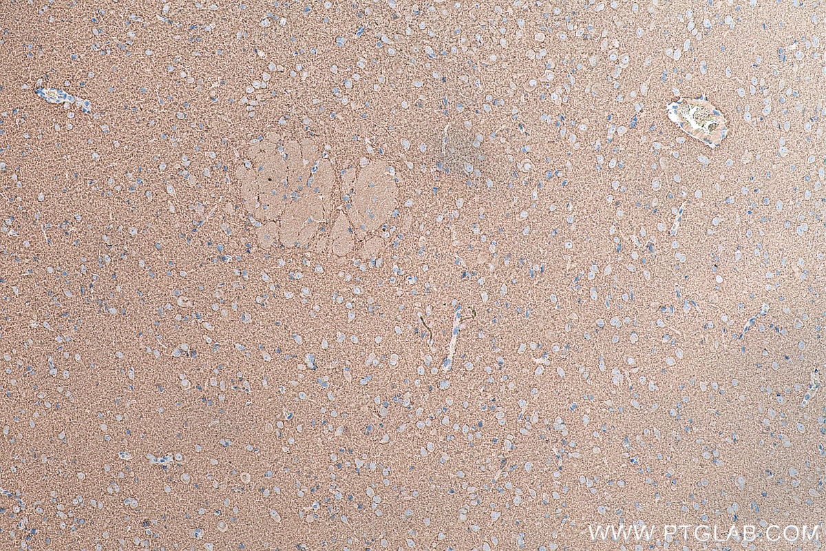 IHC staining of rat brain using 67864-1-Ig Immunohistochemistry (IHC) staining of rat brain tissue using Synaptophysin Monoclonal antibody (67864-1-Ig)