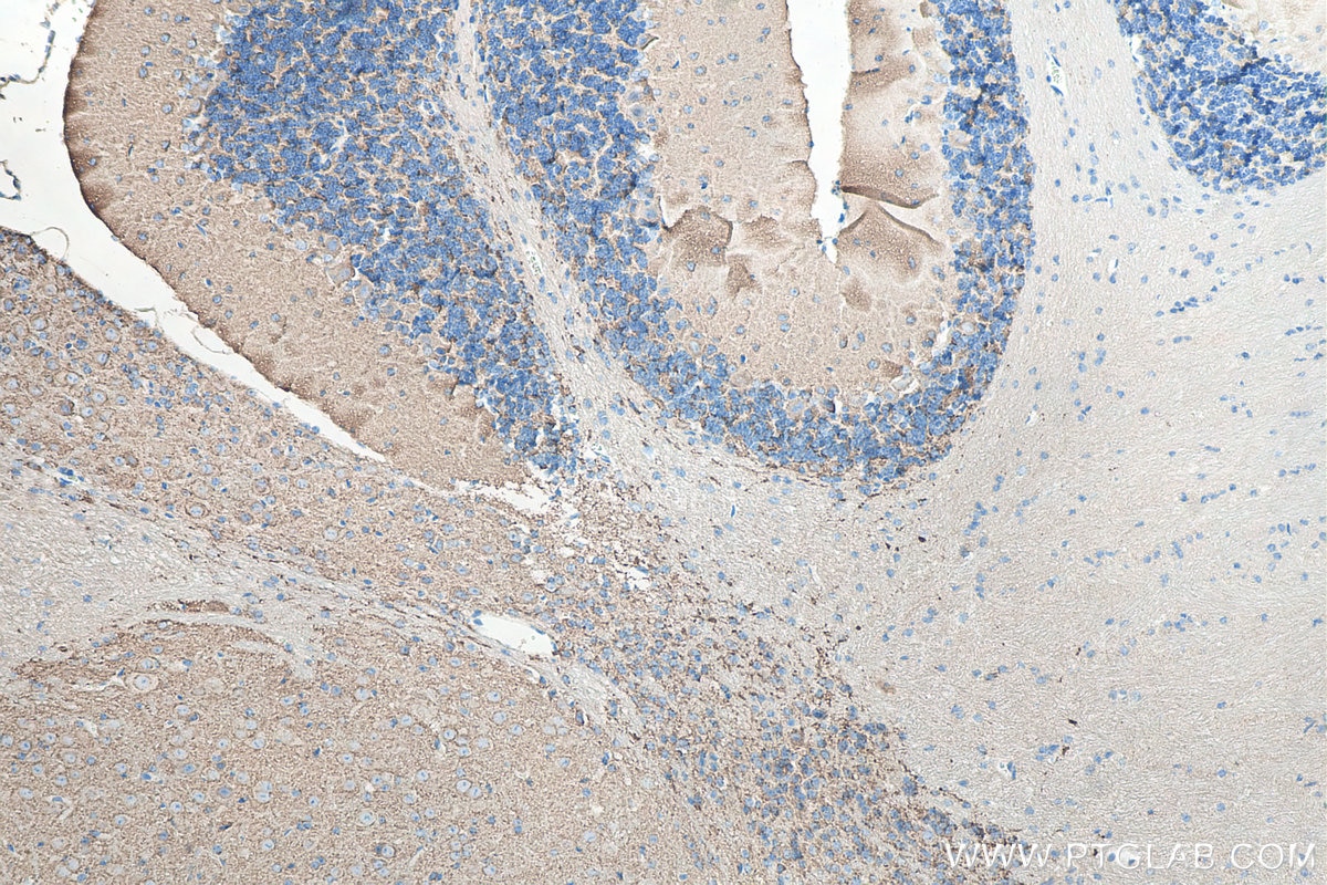 IHC staining of mouse cerebellum using 67864-1-Ig Immunohistochemistry (IHC) staining of mouse cerebellum tissue using Synaptophysin Monoclonal antibody (67864-1-Ig)