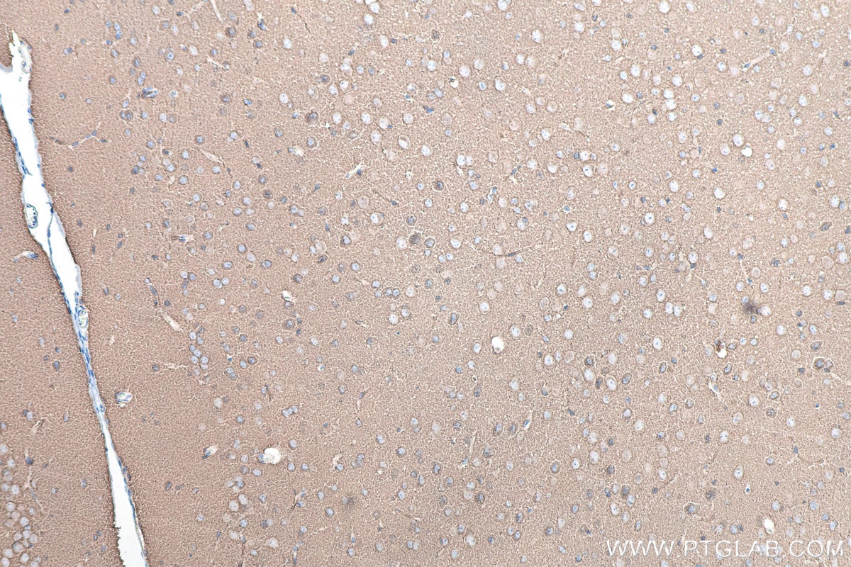 IHC staining of mouse brain using 67864-1-Ig Immunohistochemistry (IHC) staining of mouse brain tissue using Synaptophysin Monoclonal antibody (67864-1-Ig)
