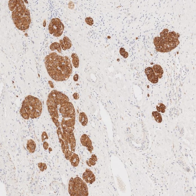 IHC staining of human pancreas using 67864-1-Ig Immunohistochemistry (IHC) staining of human pancreas tissue using Synaptophysin Monoclonal antibody (67864-1-Ig)