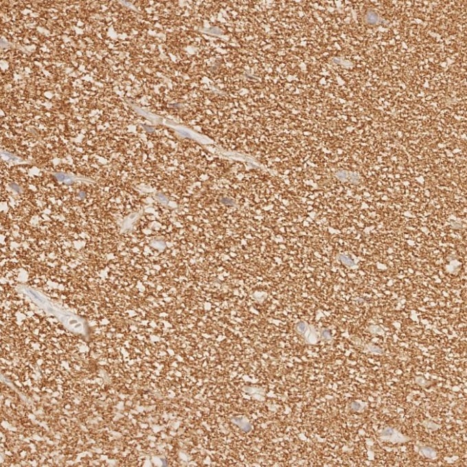 IHC staining of human brain using 67864-1-Ig Immunohistochemistry (IHC) staining of human brain tissue using Synaptophysin Monoclonal antibody (67864-1-Ig)