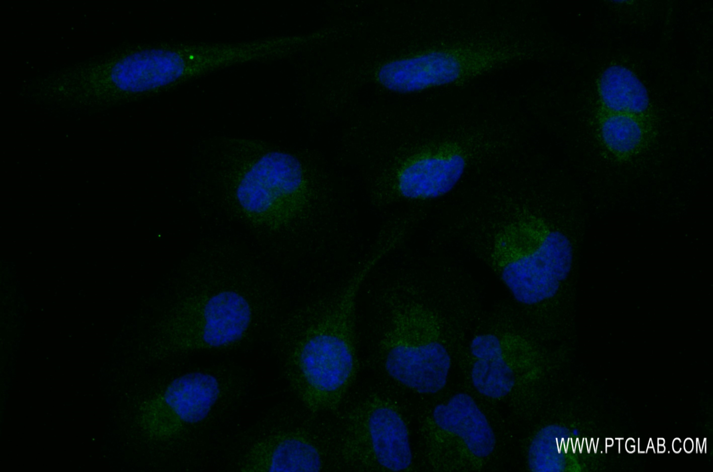 Immunofluorescence (IF) / fluorescent staining of U2OS cells using Synaptophysin Recombinant antibody (82900-1-RR)