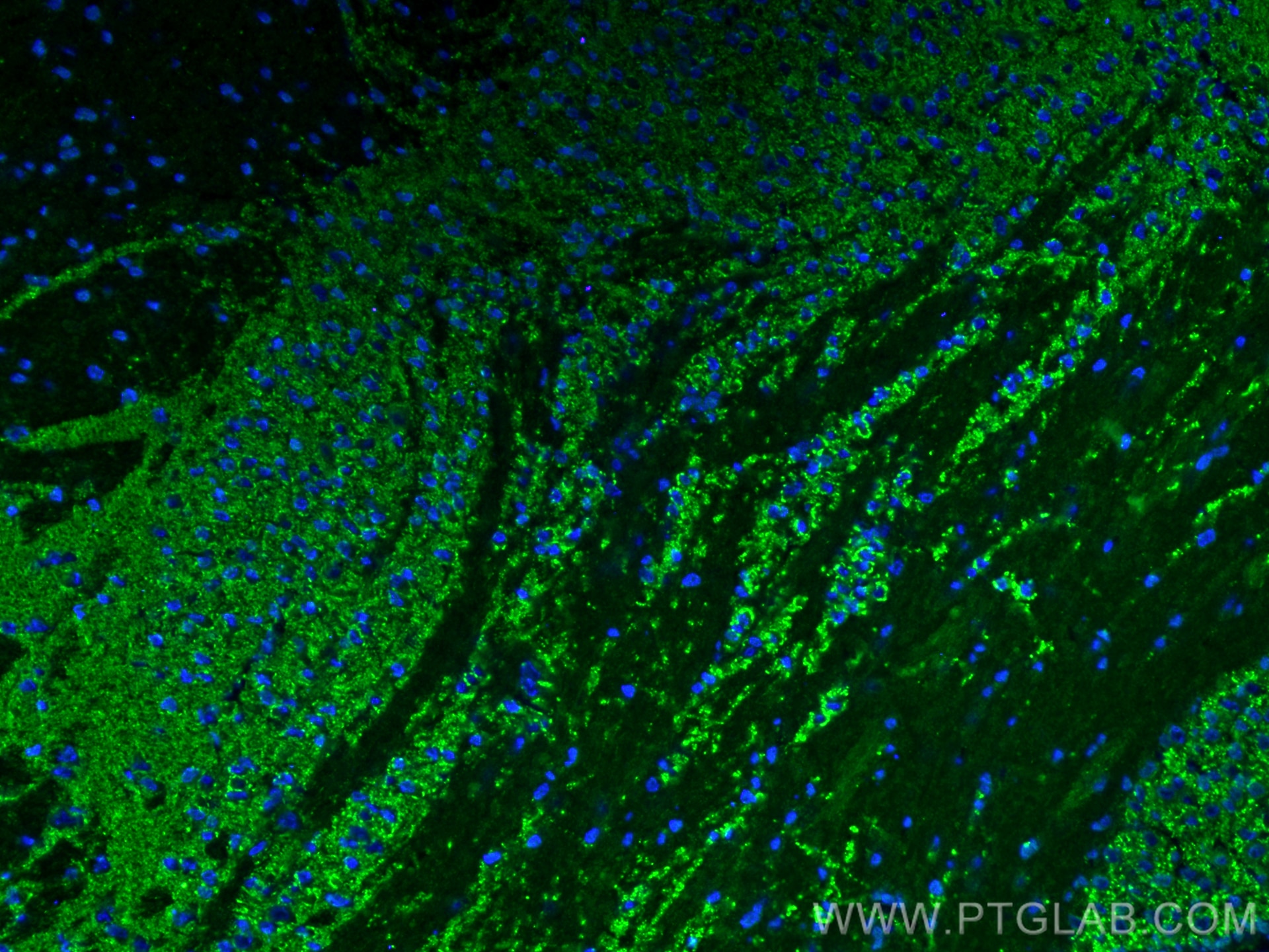 Immunofluorescence (IF) / fluorescent staining of mouse brain tissue using Synaptophysin Recombinant antibody (82900-1-RR)