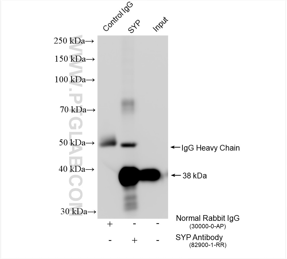 Immunoprecipitation (IP) experiment of mouse brain tissue using Synaptophysin Recombinant antibody (82900-1-RR)