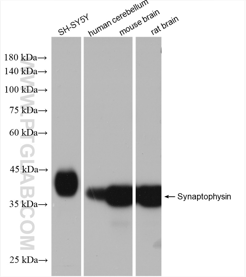 Western Blot (WB) analysis of various lysates using Synaptophysin Recombinant antibody (82900-1-RR)