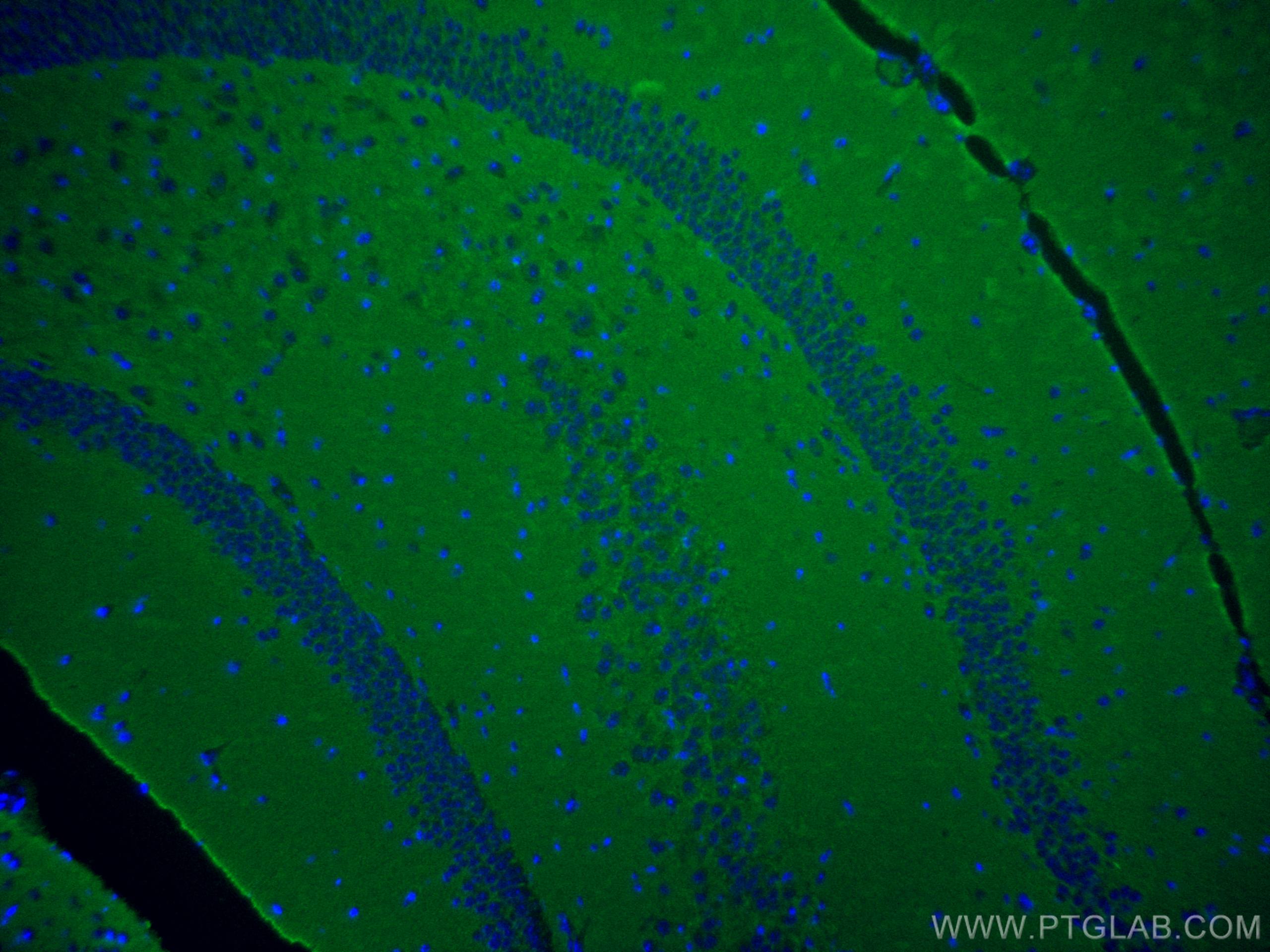 Immunofluorescence (IF) / fluorescent staining of mouse brain tissue using CoraLite® Plus 488-conjugated Synaptophysin Polycl (CL488-17785)