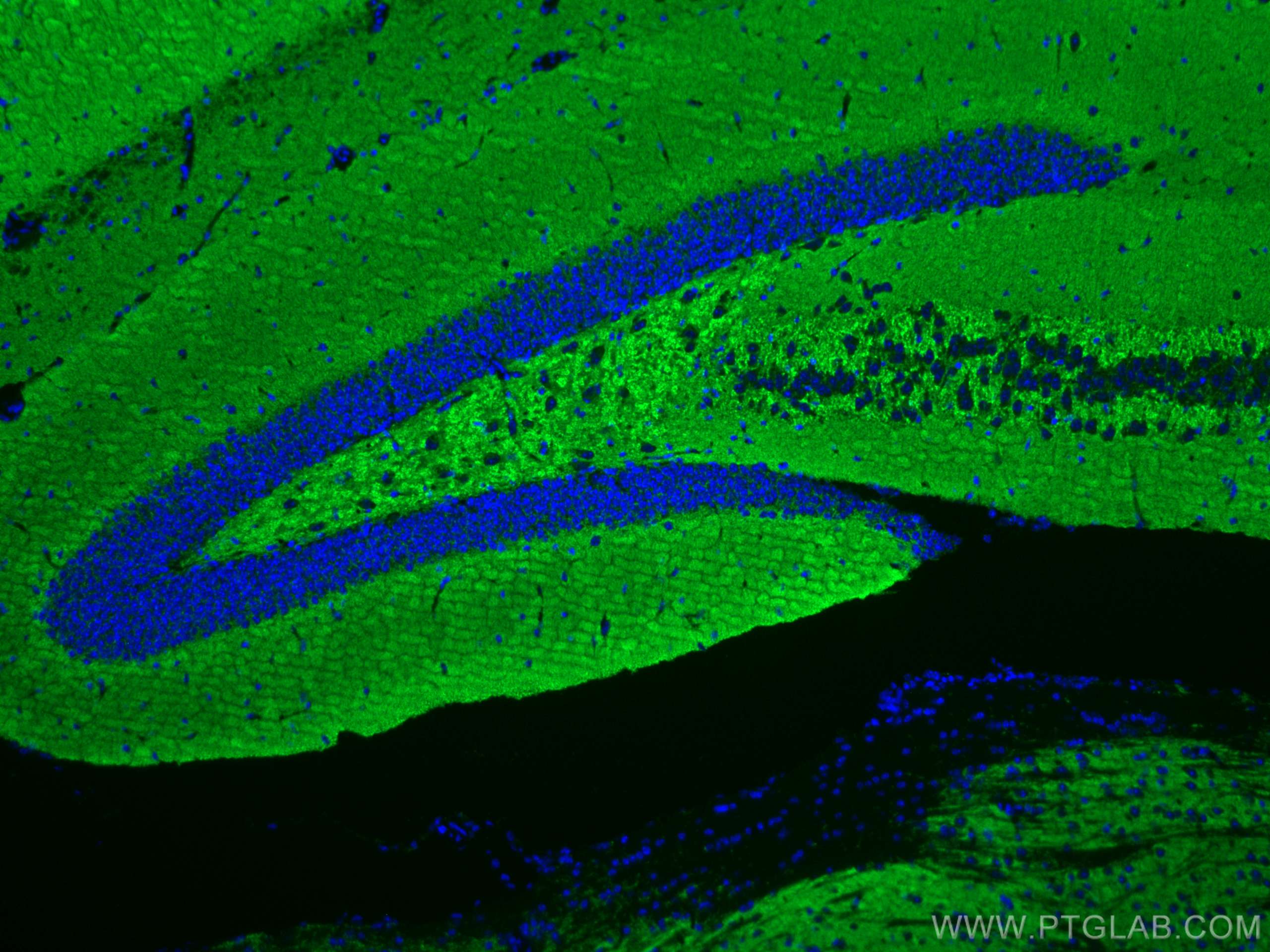 IF Staining of mouse brain using CL488-67864