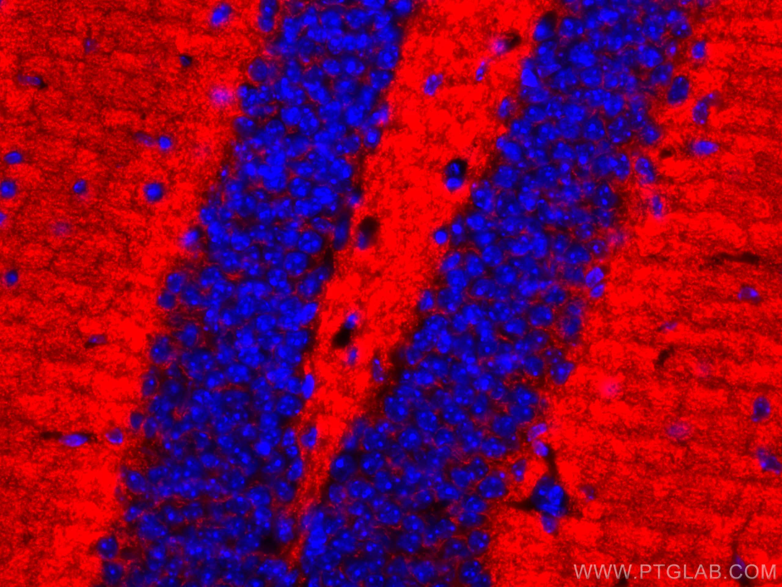 Immunofluorescence (IF) / fluorescent staining of mouse brain tissue using CoraLite®594-conjugated Synaptophysin Monoclonal a (CL594-67864)