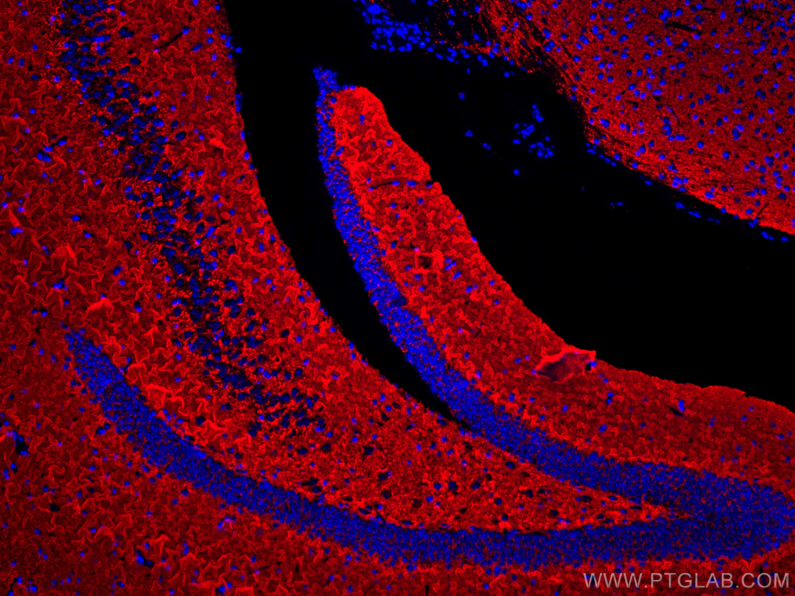 IF Staining of mouse brain using CL594-67864