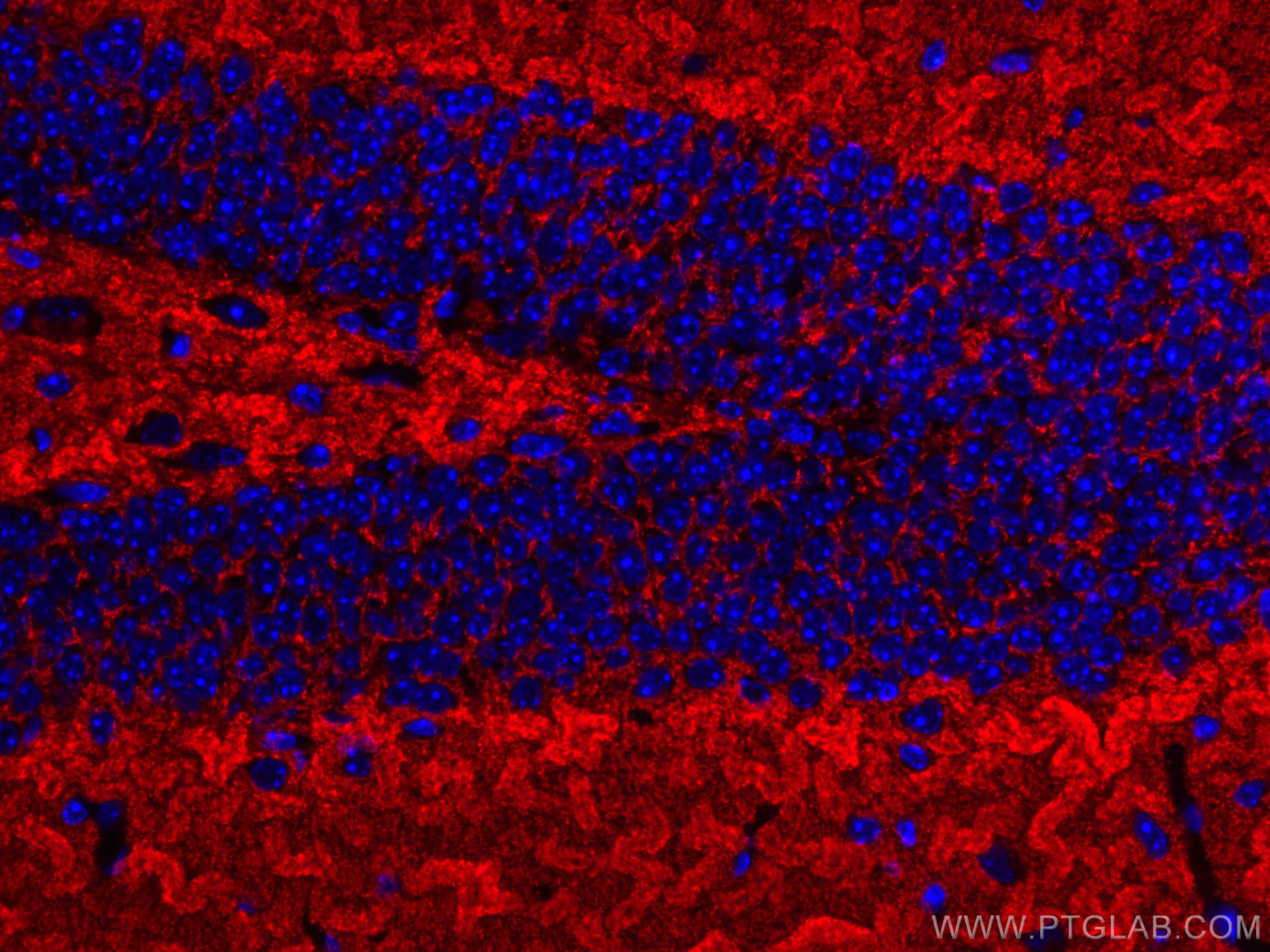 Immunofluorescence (IF) / fluorescent staining of mouse brain tissue using CoraLite®594-conjugated Synaptophysin Monoclonal a (CL594-67864)