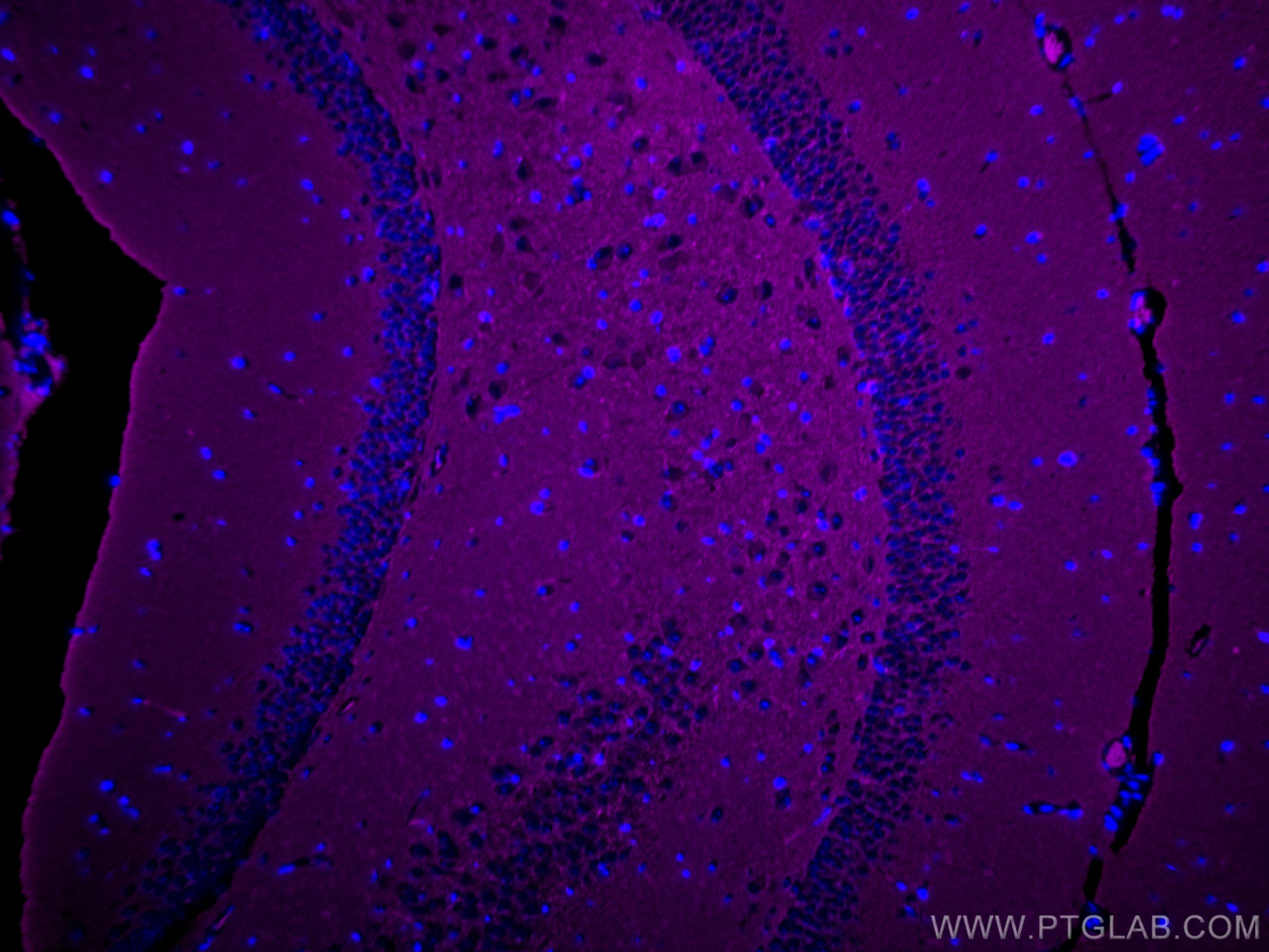 IF Staining of mouse brain using CL647-17785