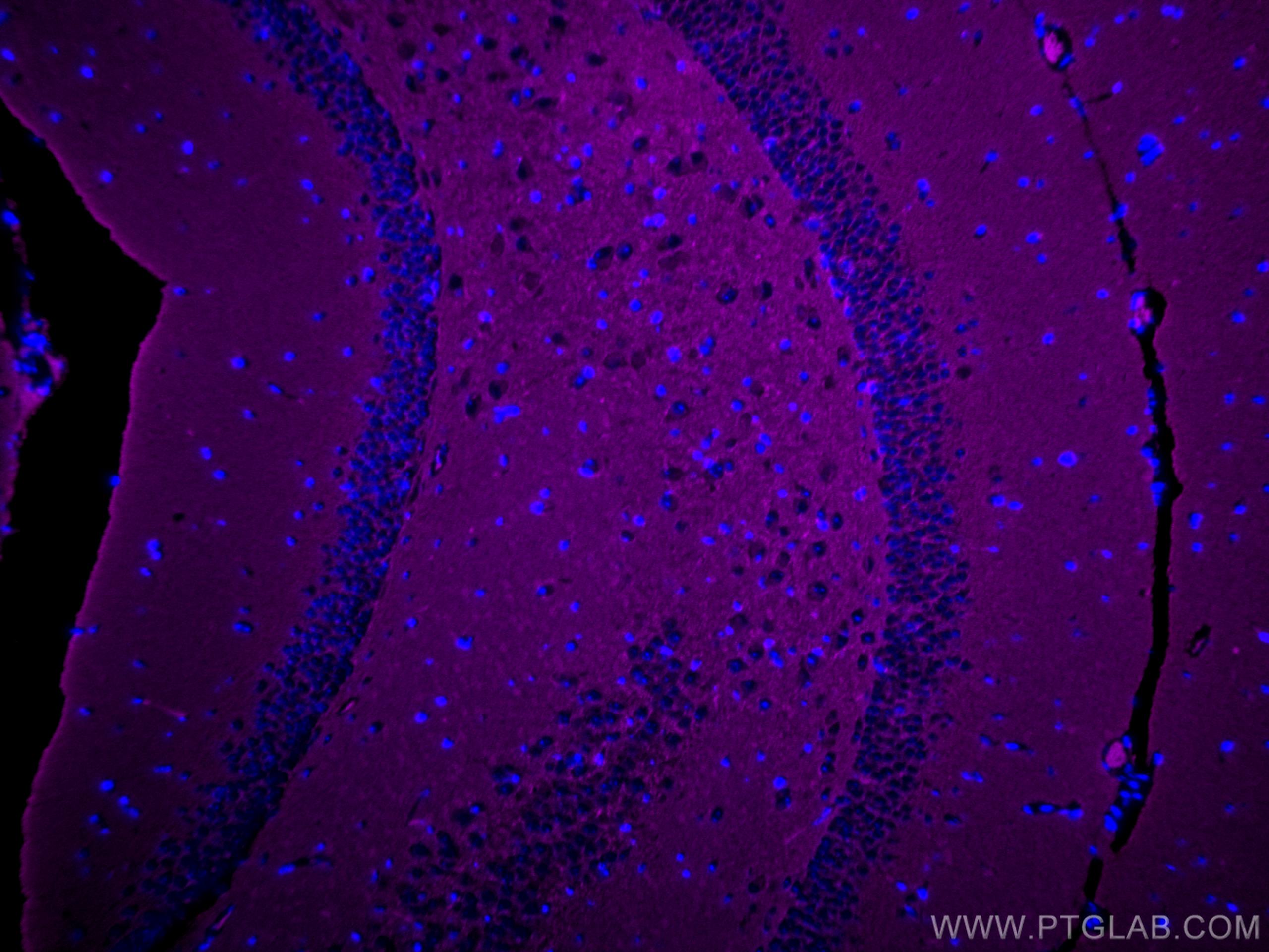 Immunofluorescence (IF) / fluorescent staining of mouse brain tissue using CoraLite® Plus 647-conjugated Synaptophysin Polycl (CL647-17785)