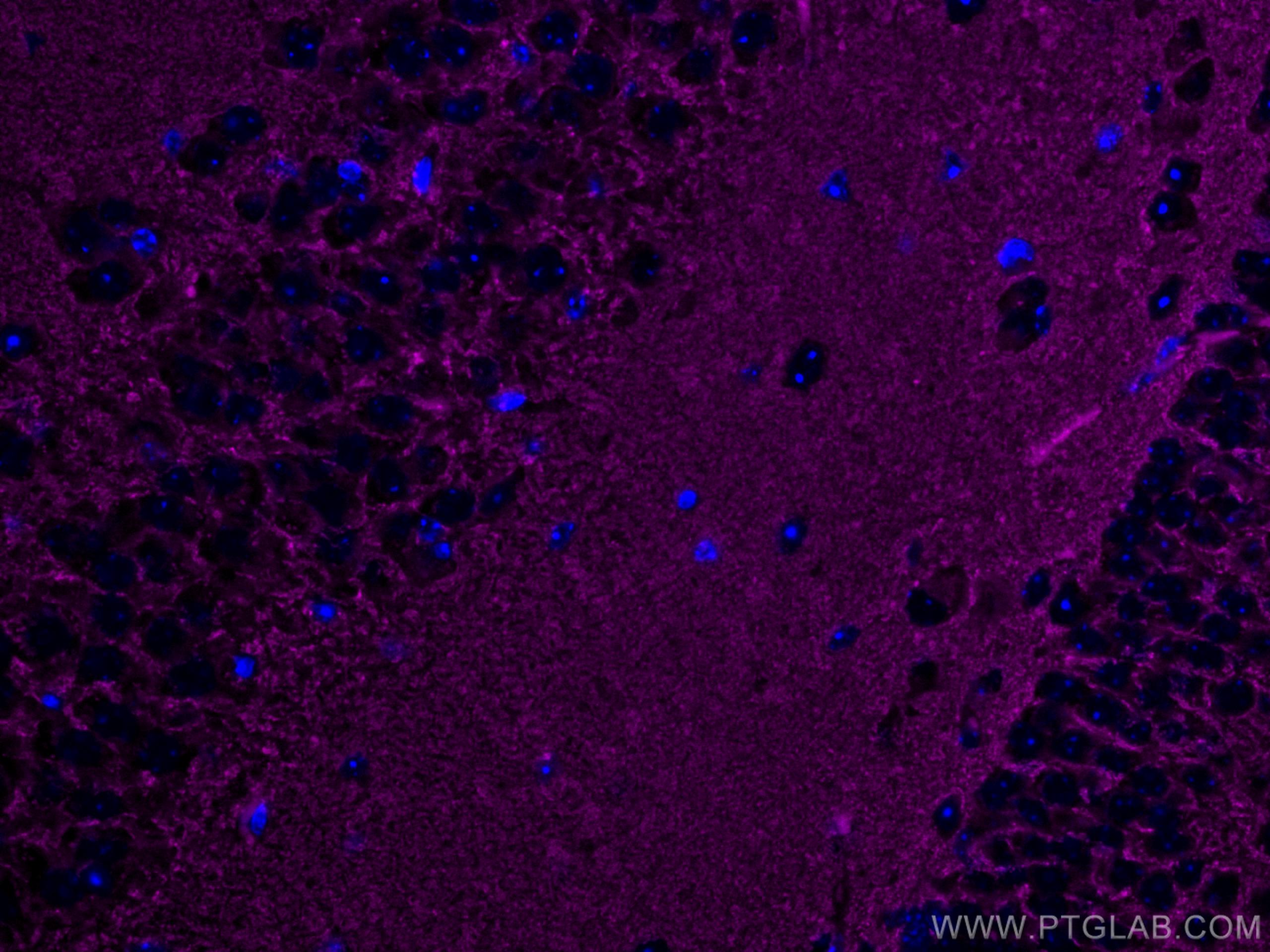Immunofluorescence (IF) / fluorescent staining of mouse brain tissue using CoraLite® Plus 647-conjugated Synaptophysin Polycl (CL647-17785)