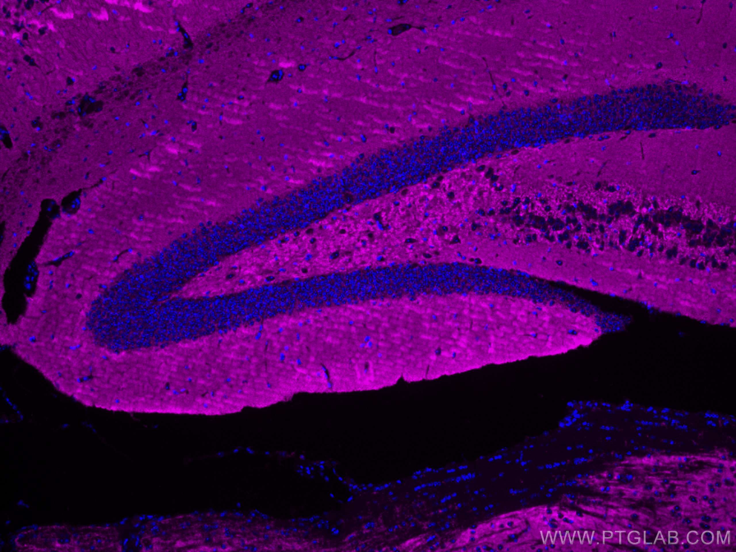 IF Staining of mouse brain using CL647-67864