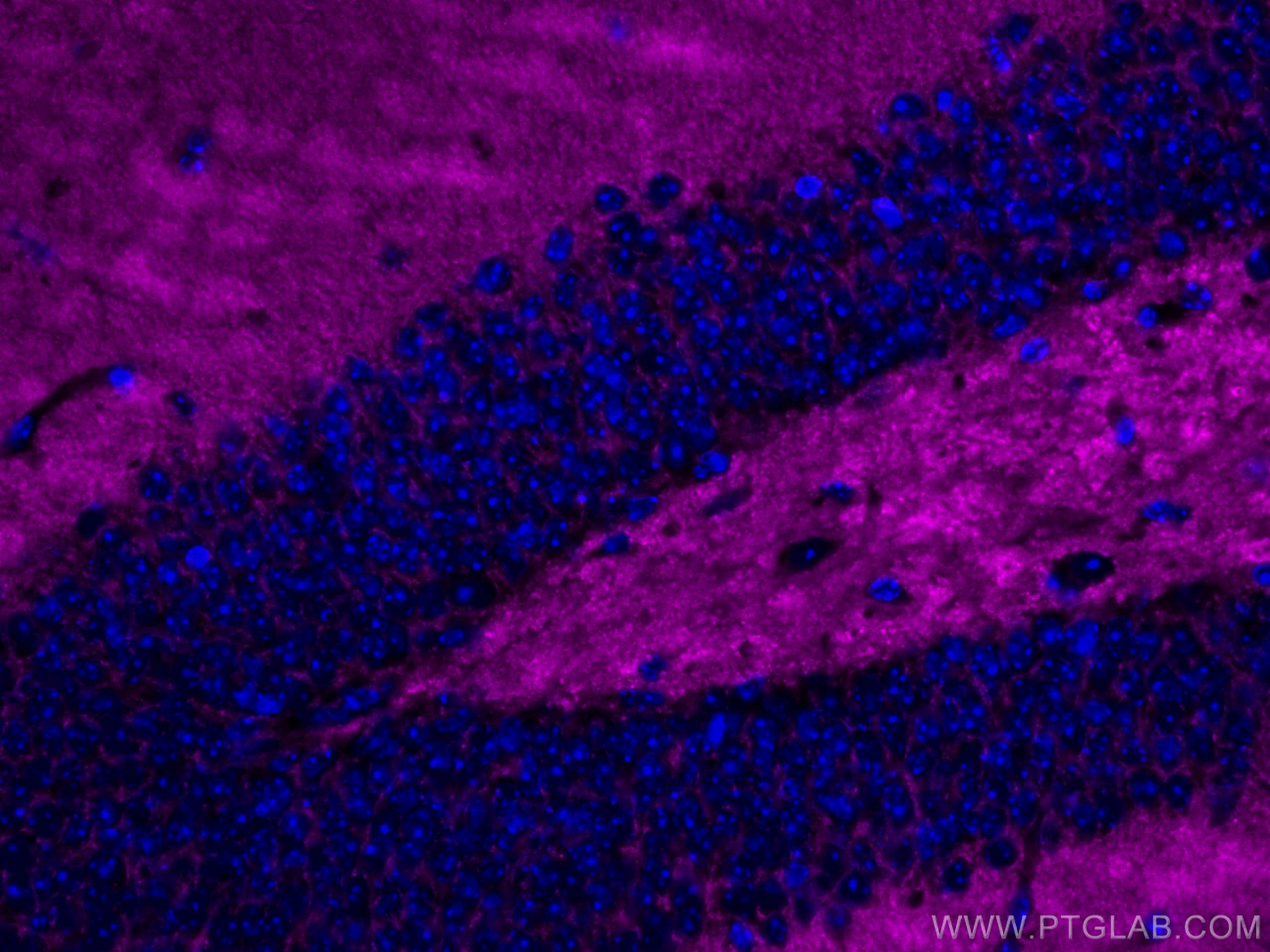 Immunofluorescence (IF) / fluorescent staining of mouse brain tissue using CoraLite® Plus 647-conjugated Synaptophysin Monocl (CL647-67864)