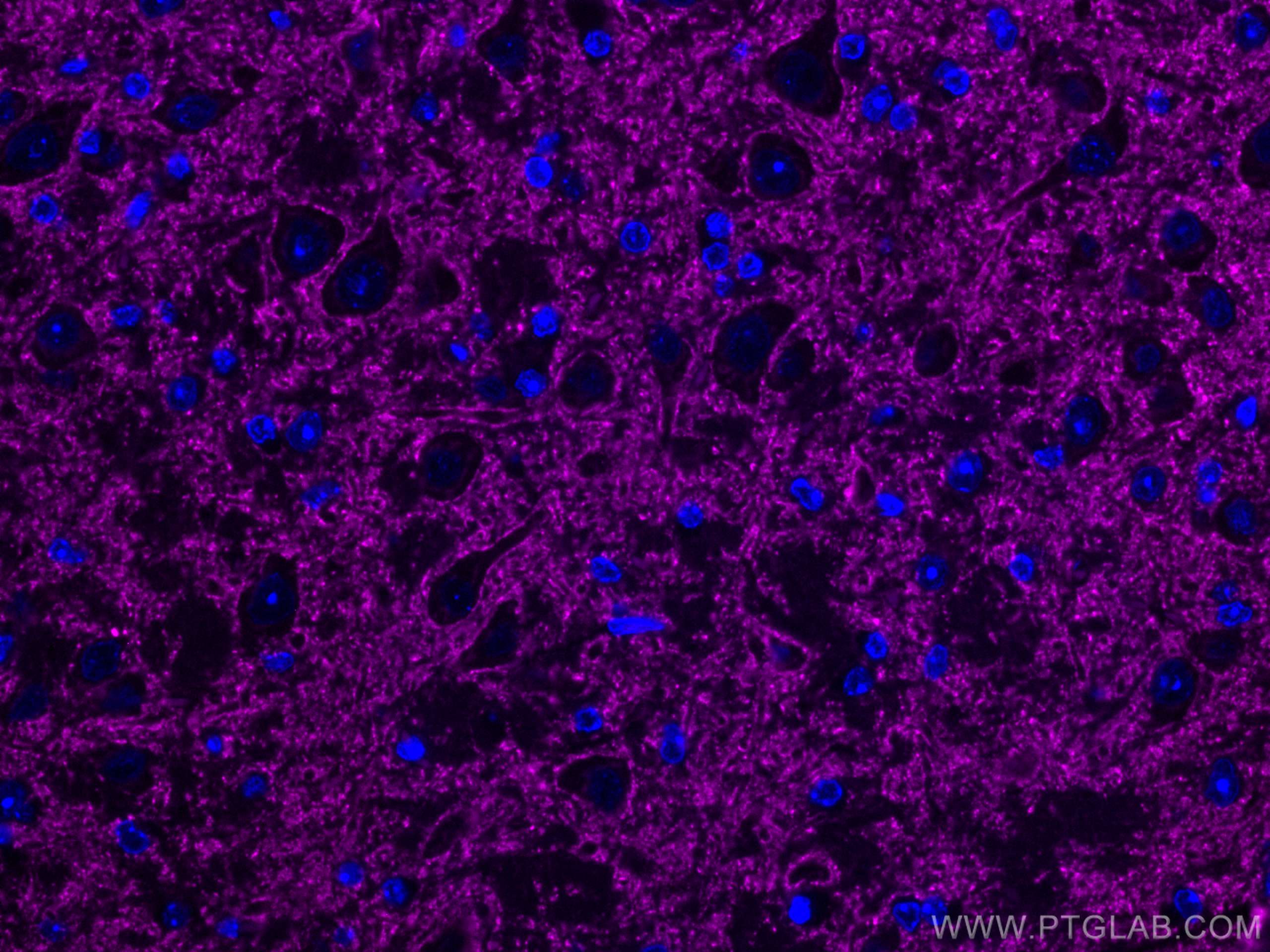 IF Staining of mouse brain using CL647-67864