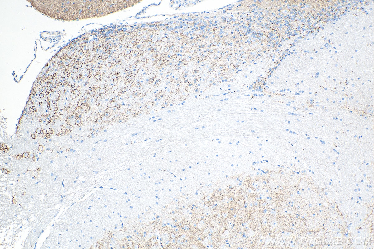 Immunohistochemistry (IHC) staining of mouse cerebellum tissue using Synaptotagmin-1 Monoclonal antibody (68043-1-Ig)