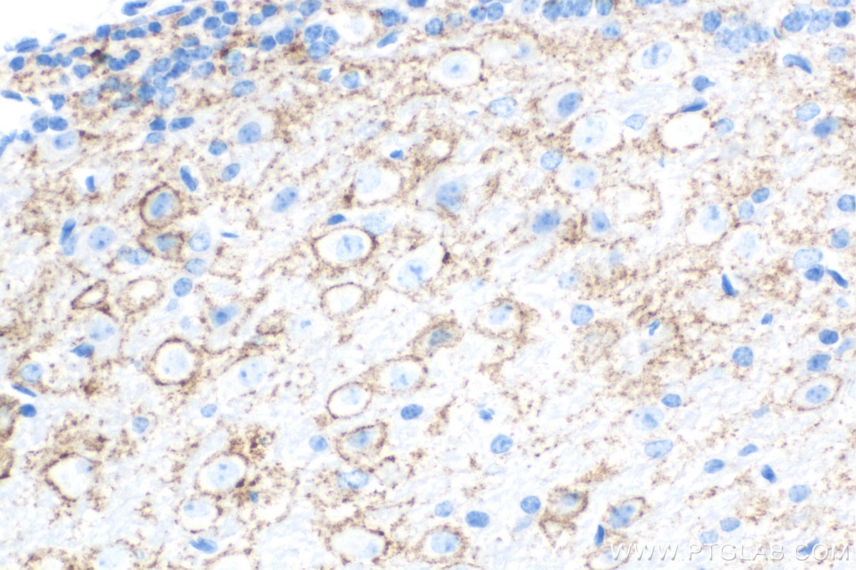 IHC staining of mouse cerebellum using 68043-1-Ig