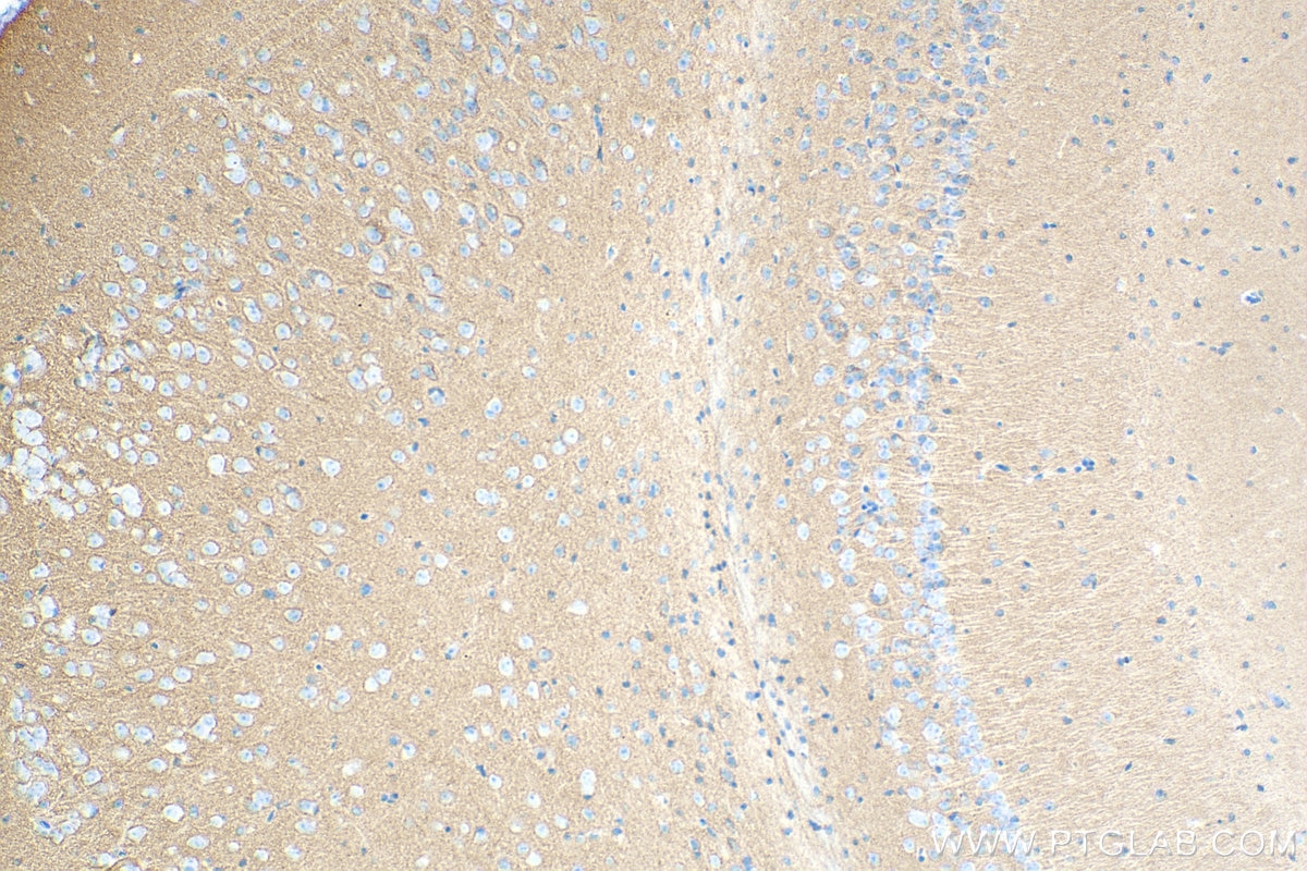 Immunohistochemistry (IHC) staining of mouse brain tissue using Synaptotagmin-1 Monoclonal antibody (68043-1-Ig)