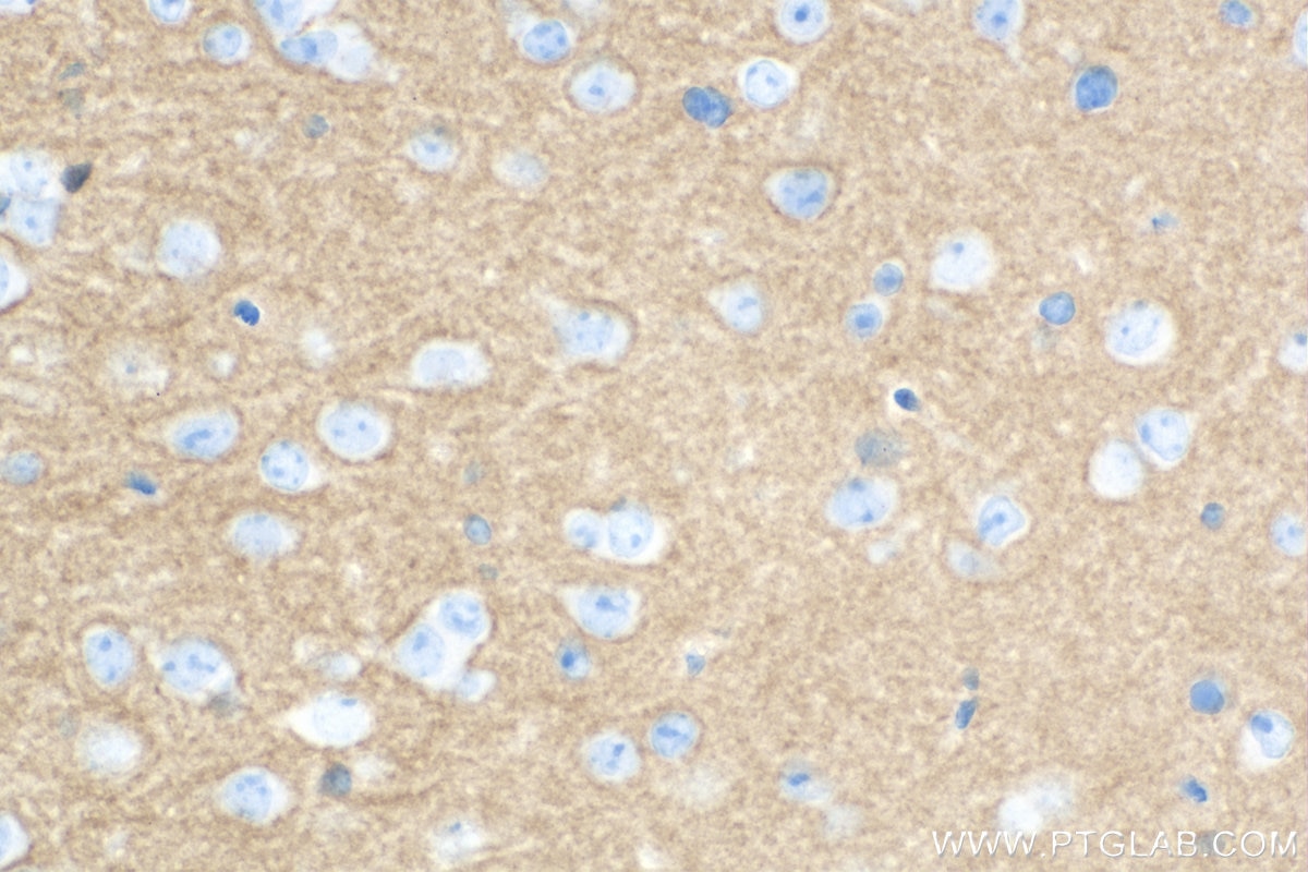 Immunohistochemistry (IHC) staining of mouse brain tissue using Synaptotagmin-1 Monoclonal antibody (68043-1-Ig)