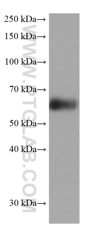 Western Blot (WB) analysis of rat cerebellum tissue using Synaptotagmin-1 Monoclonal antibody (68043-1-Ig)