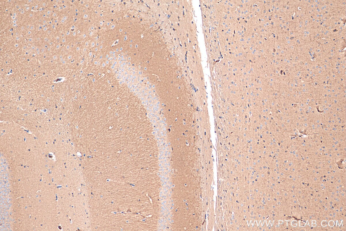 Immunohistochemistry (IHC) staining of mouse brain tissue using Synaptotagmin-3 Polyclonal antibody (28667-1-AP)
