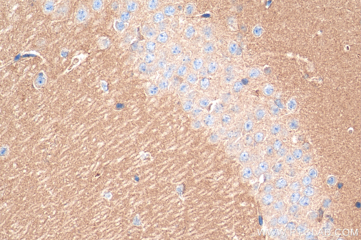 Immunohistochemistry (IHC) staining of mouse brain tissue using Synaptotagmin-3 Polyclonal antibody (28667-1-AP)