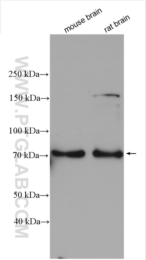 Western Blot (WB) analysis of various lysates using Synaptotagmin-3 Polyclonal antibody (28667-1-AP)