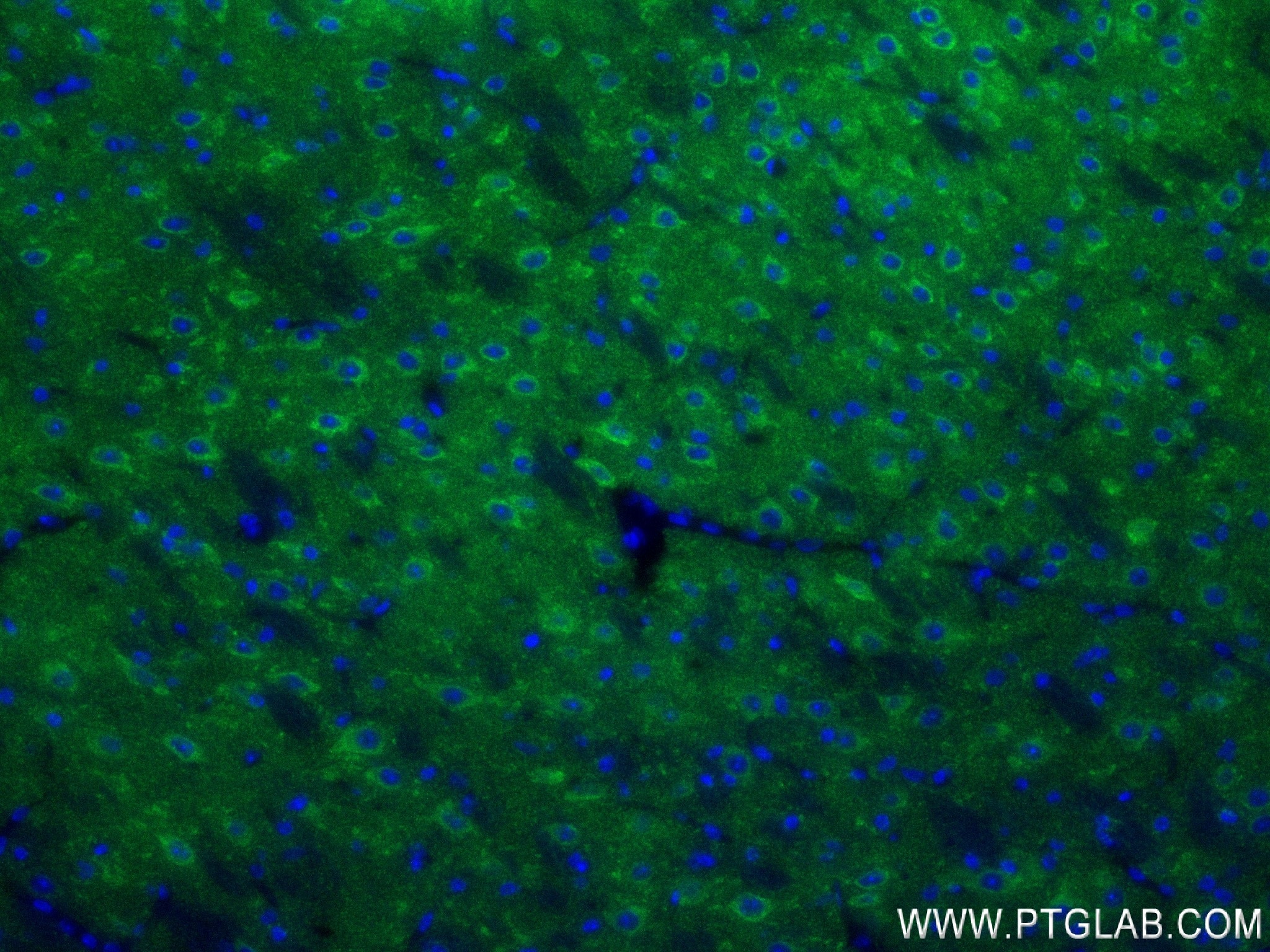 Immunofluorescence (IF) / fluorescent staining of mouse brain tissue using Synaptotagmin-5 Recombinant antibody (84452-1-RR)