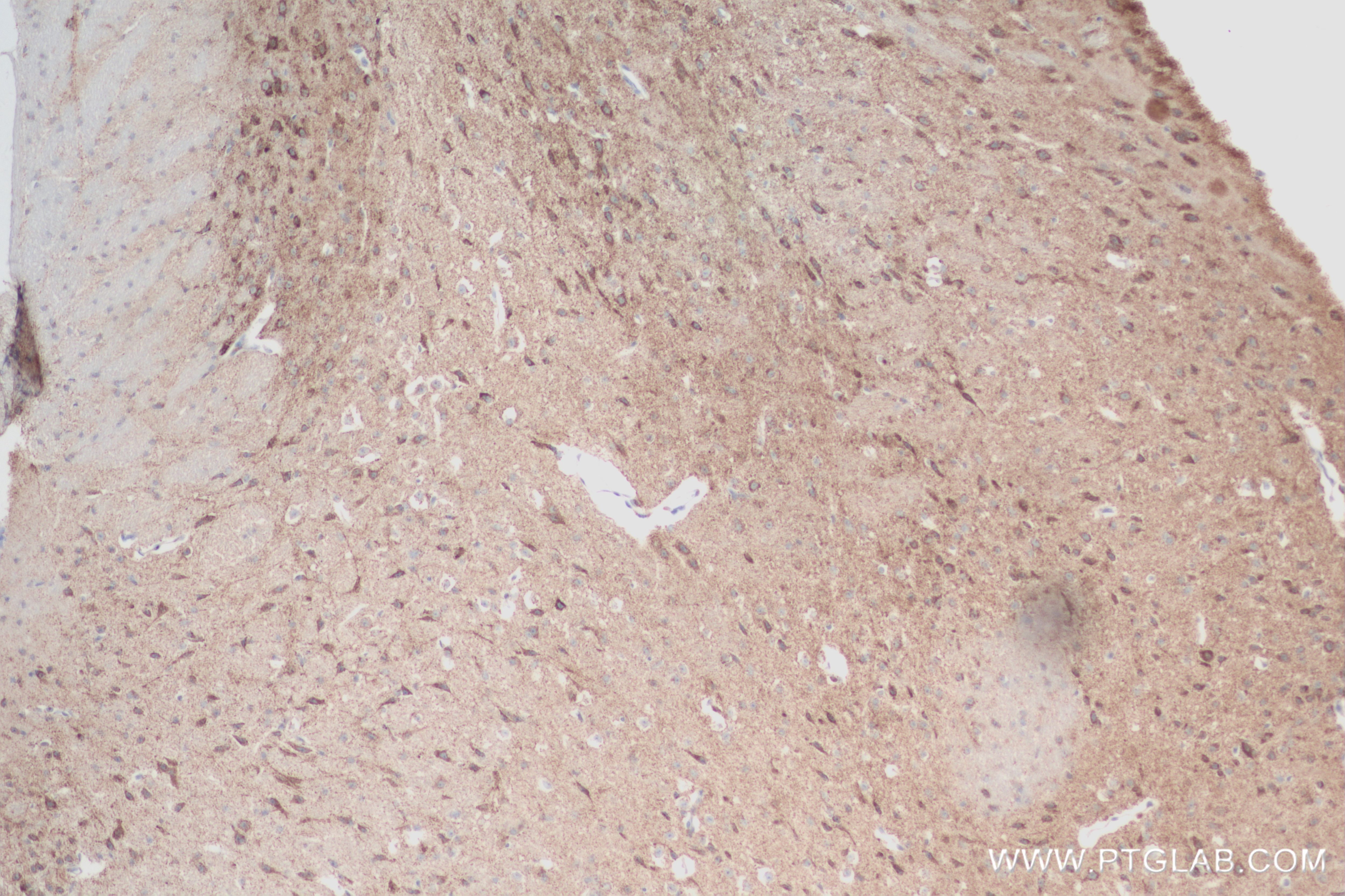 Immunohistochemistry (IHC) staining of mouse brain tissue using Synaptotagmin-5 Recombinant antibody (84452-1-RR)