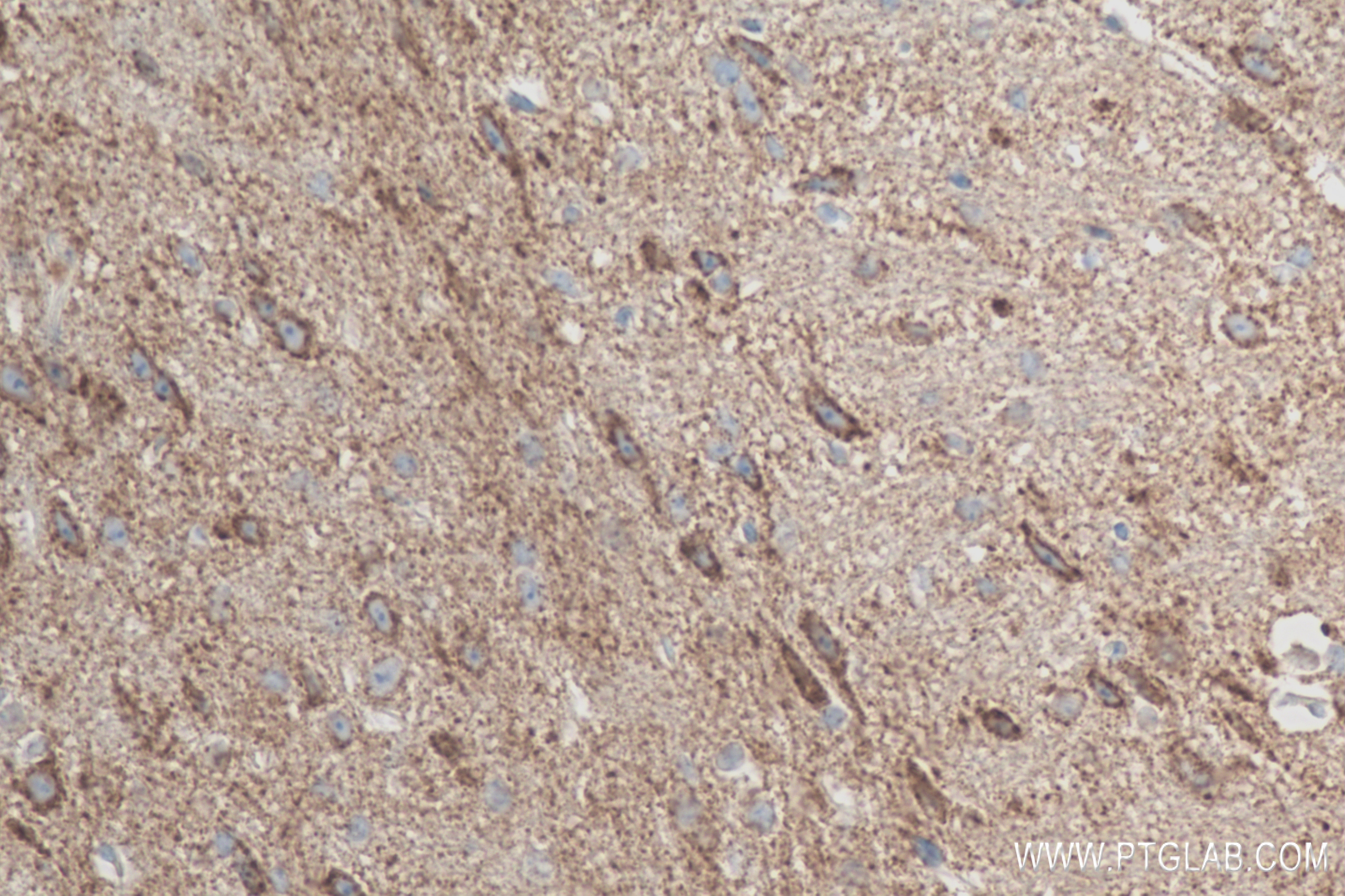 Immunohistochemistry (IHC) staining of mouse brain tissue using Synaptotagmin-5 Recombinant antibody (84452-1-RR)