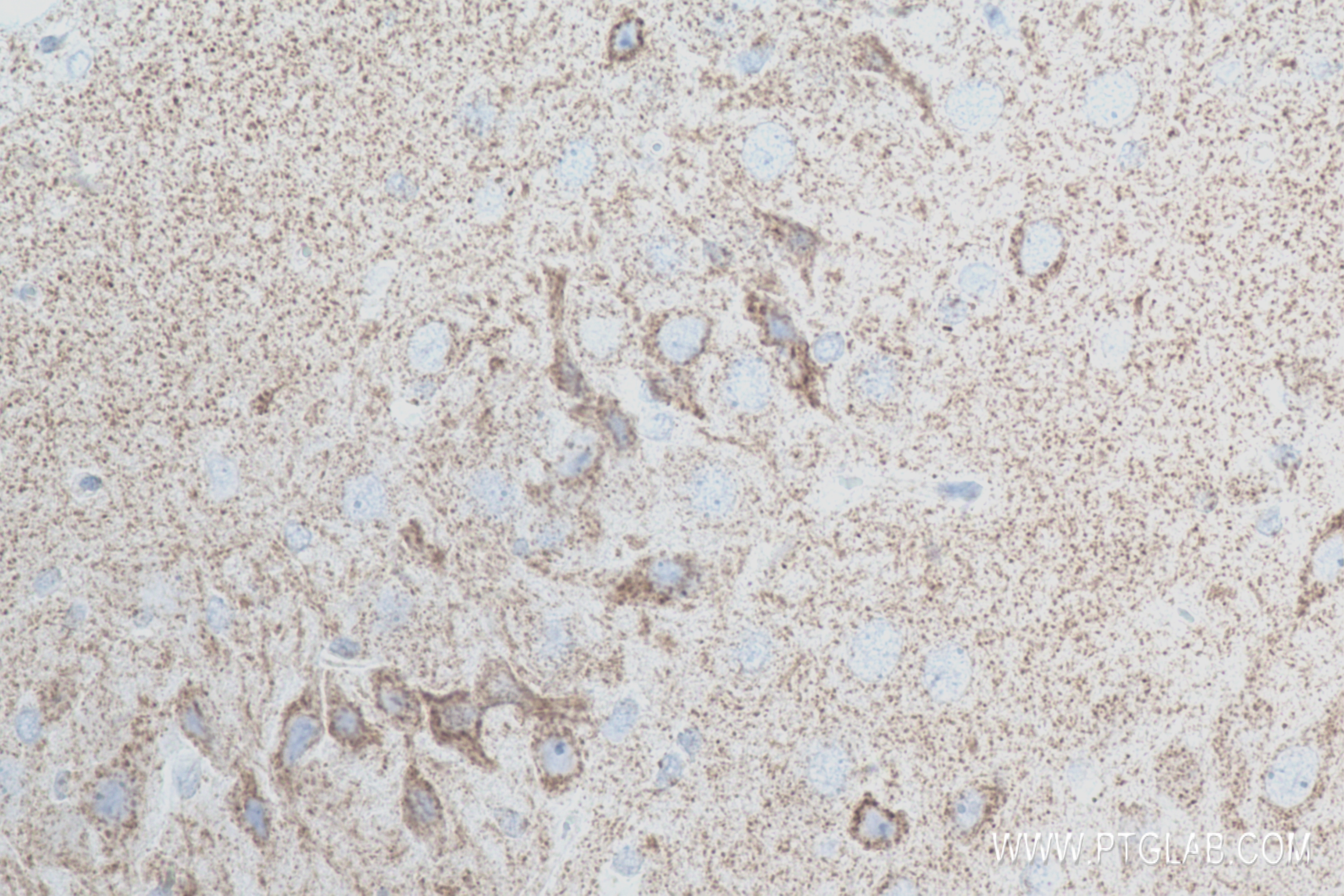 Synaptotagmin-5