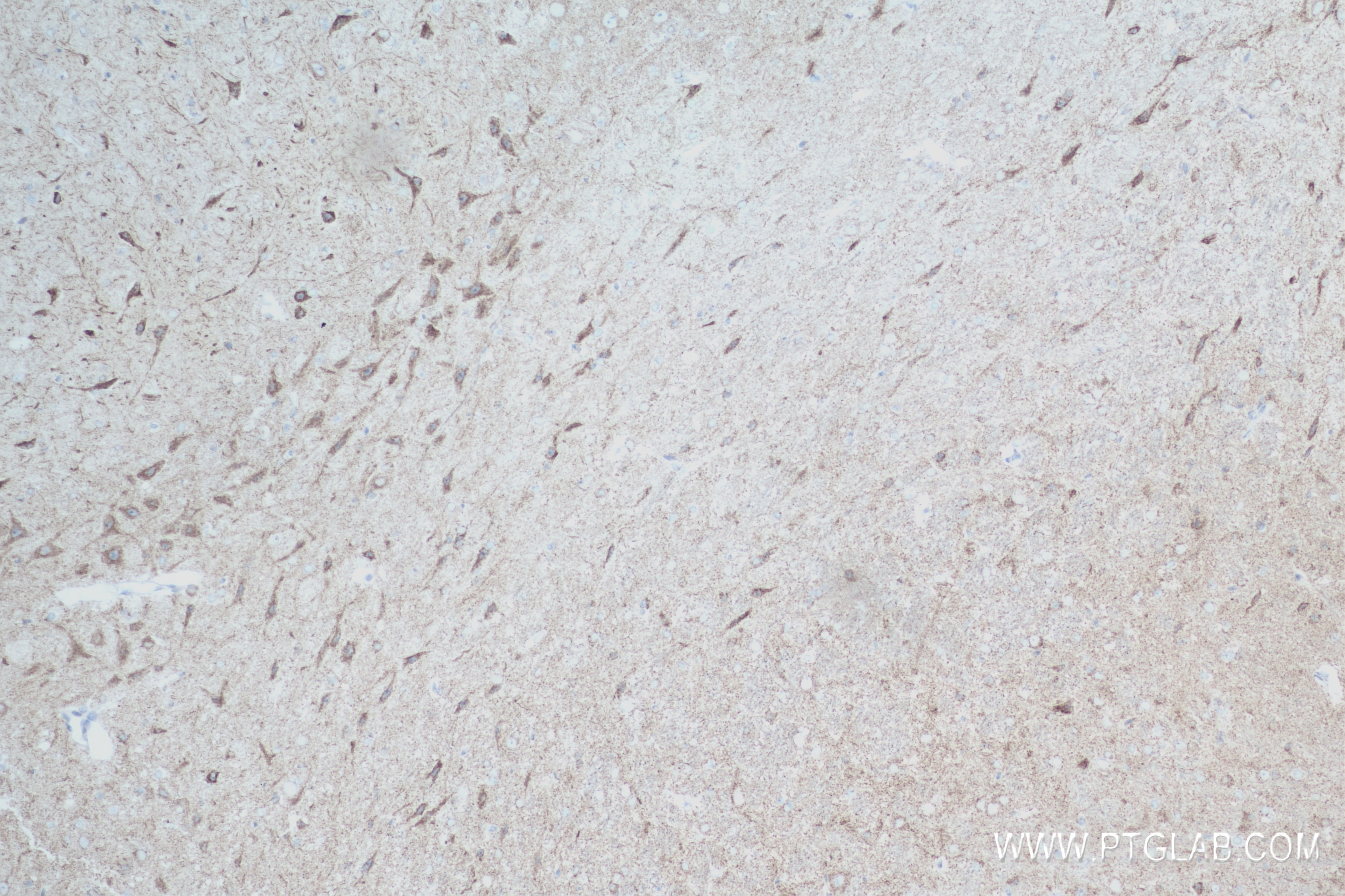 Immunohistochemistry (IHC) staining of rat brain tissue using Synaptotagmin-5 Recombinant antibody (84452-1-RR)