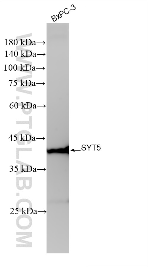 Western Blot (WB) analysis of BxPC-3 cells using Synaptotagmin-5 Recombinant antibody (84452-1-RR)