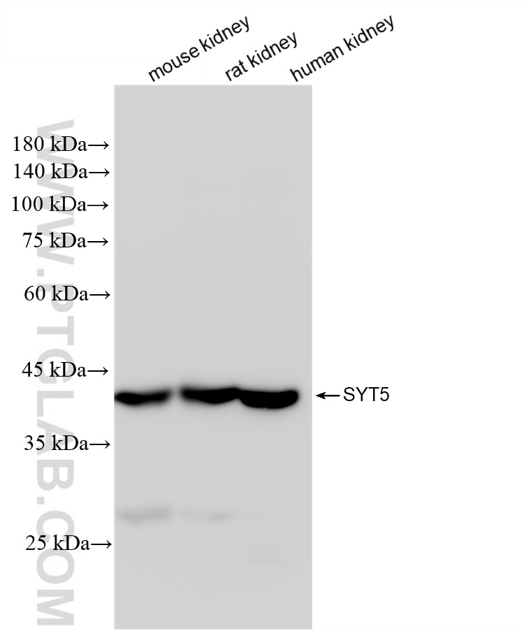 Western Blot (WB) analysis of various lysates using Synaptotagmin-5 Recombinant antibody (84452-1-RR)