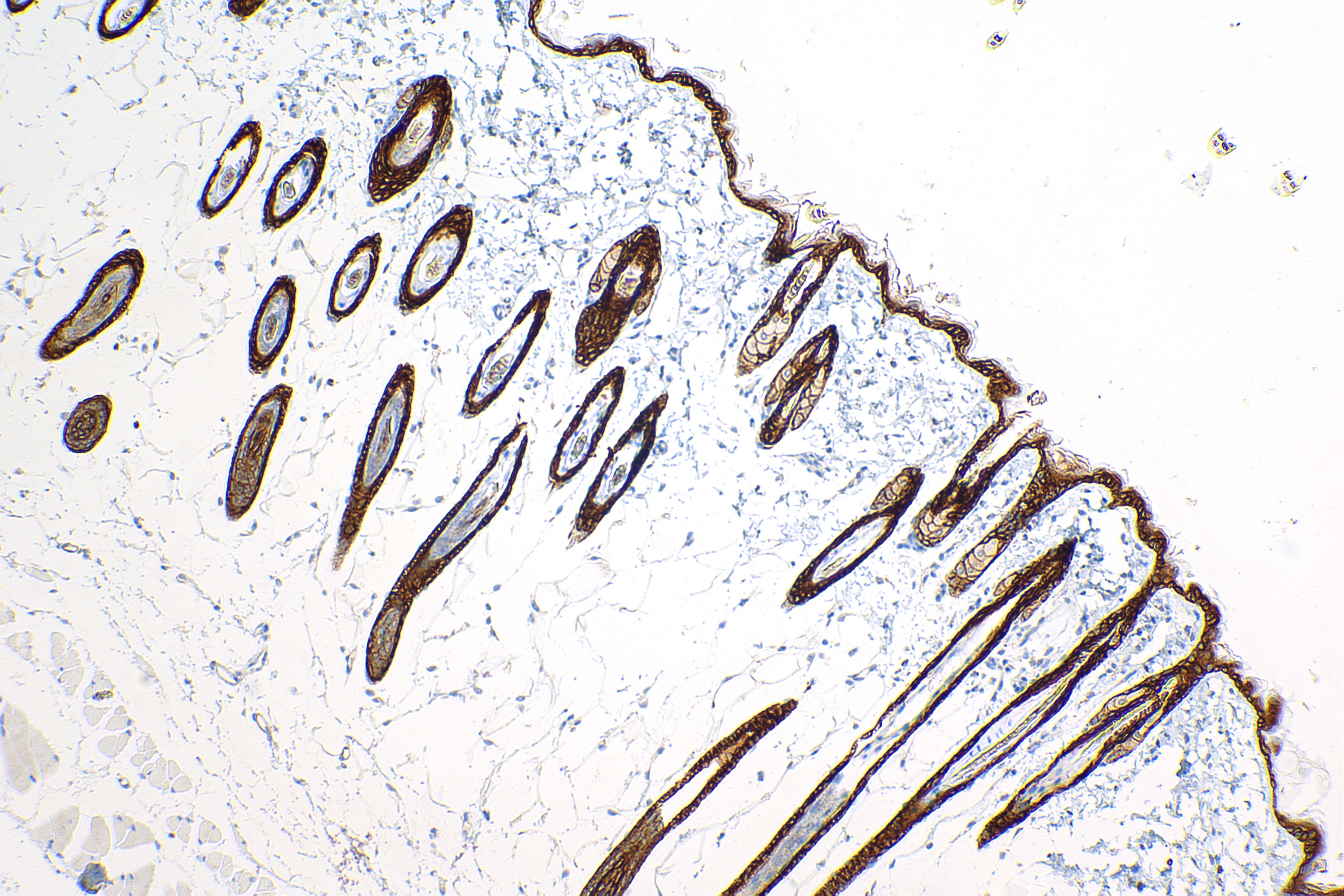 Immunohistochemistry (IHC) staining of mouse skin tissue using Syndecan-1/CD138 Recombinant antibody (84069-8-RR)