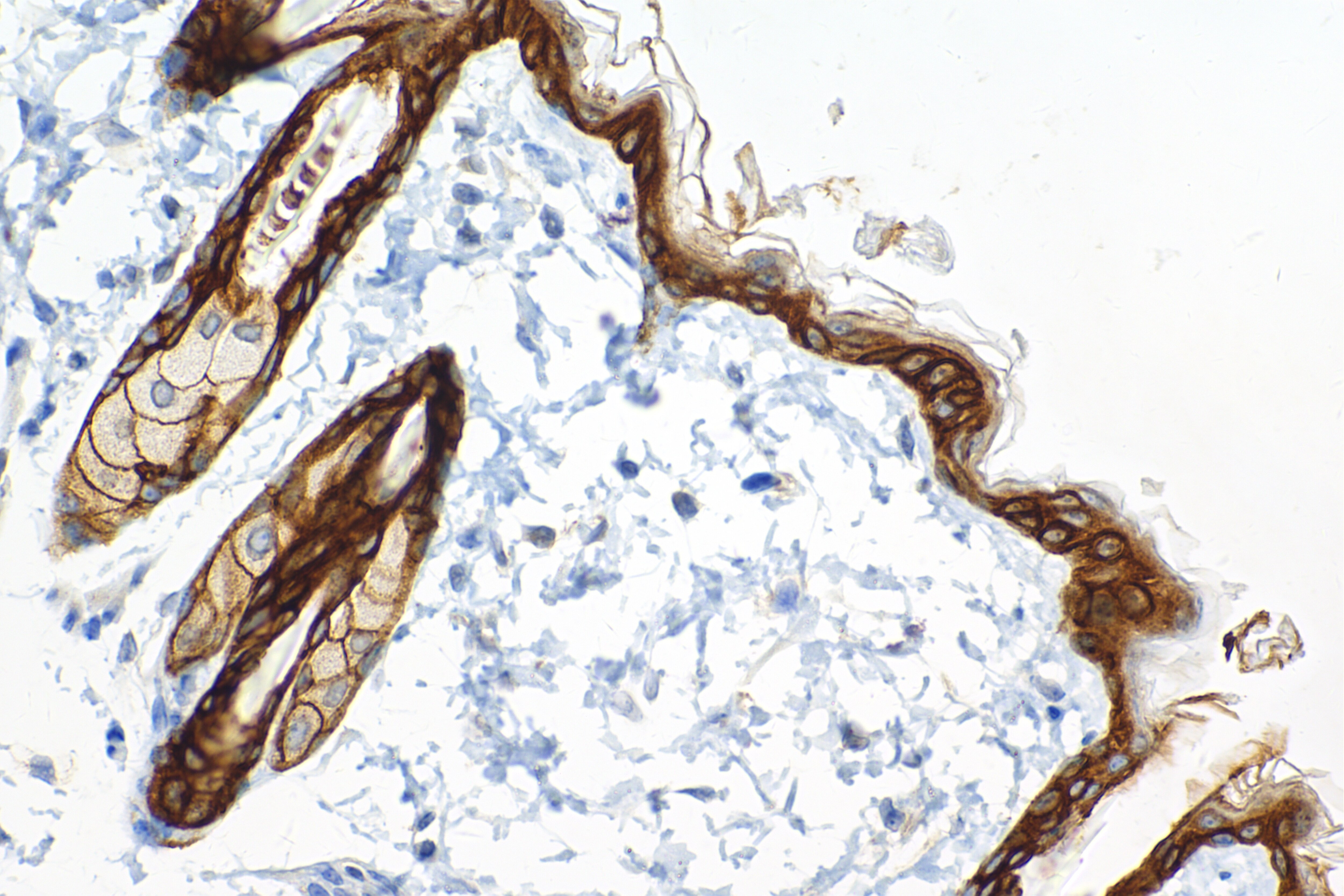 Immunohistochemistry (IHC) staining of mouse skin tissue using Syndecan-1/CD138 Recombinant antibody (84069-8-RR)