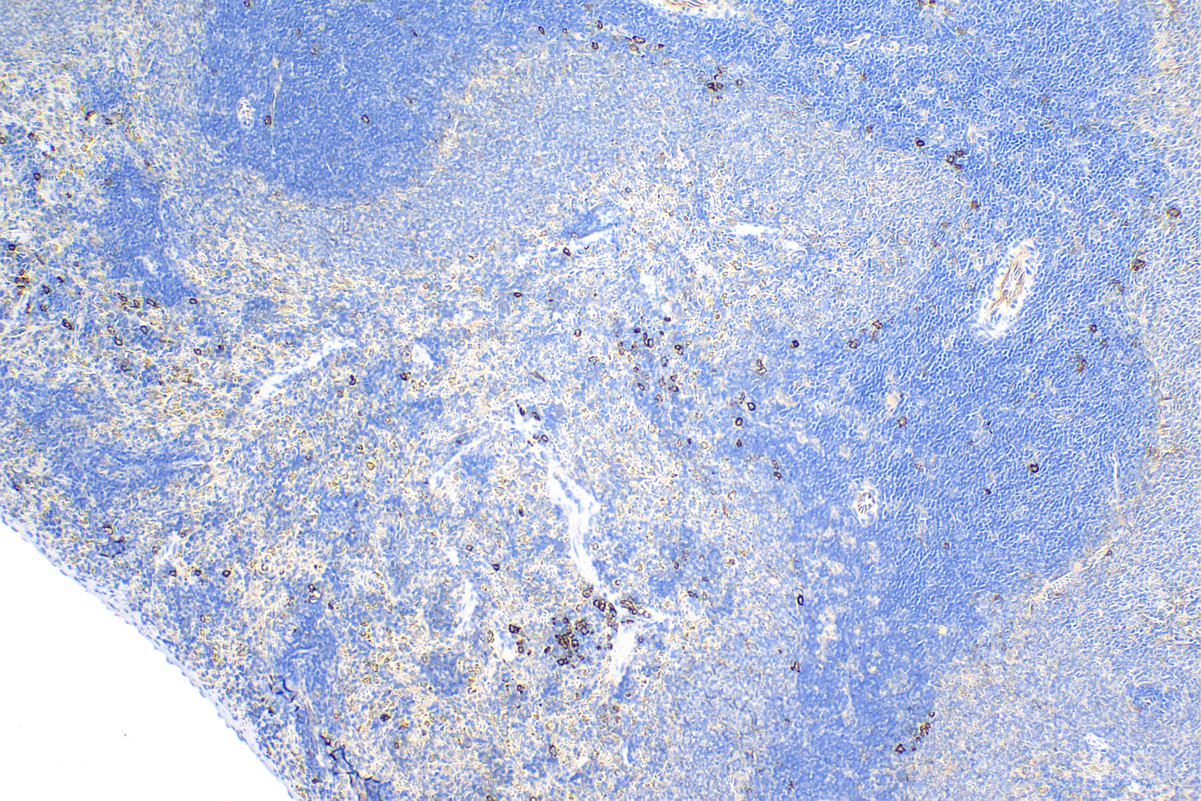 Immunohistochemistry (IHC) staining of rat spleen tissue using Syndecan-1/CD138 Recombinant antibody (84069-8-RR)