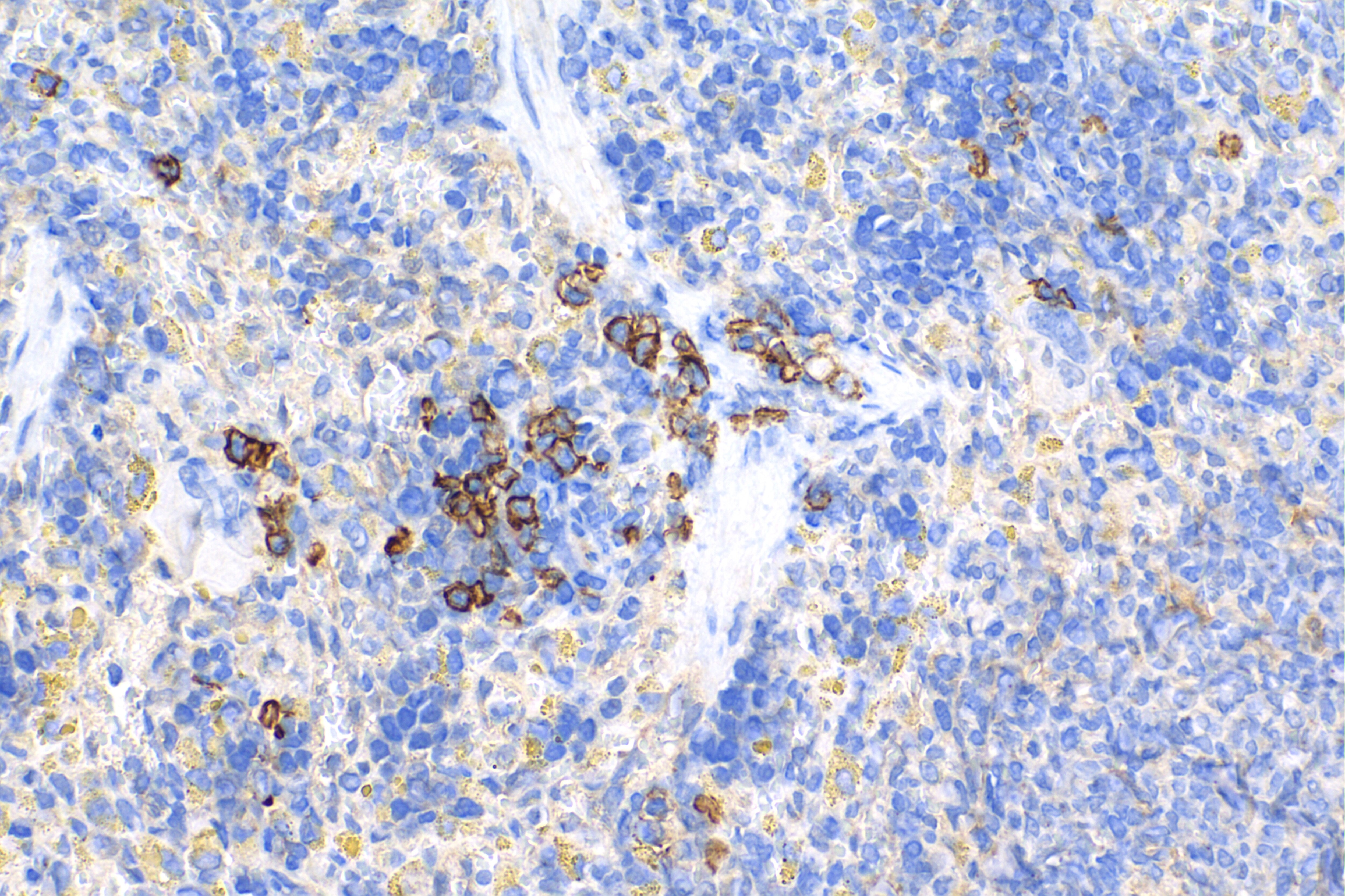 Immunohistochemistry (IHC) staining of rat spleen tissue using Syndecan-1/CD138 Recombinant antibody (84069-8-RR)
