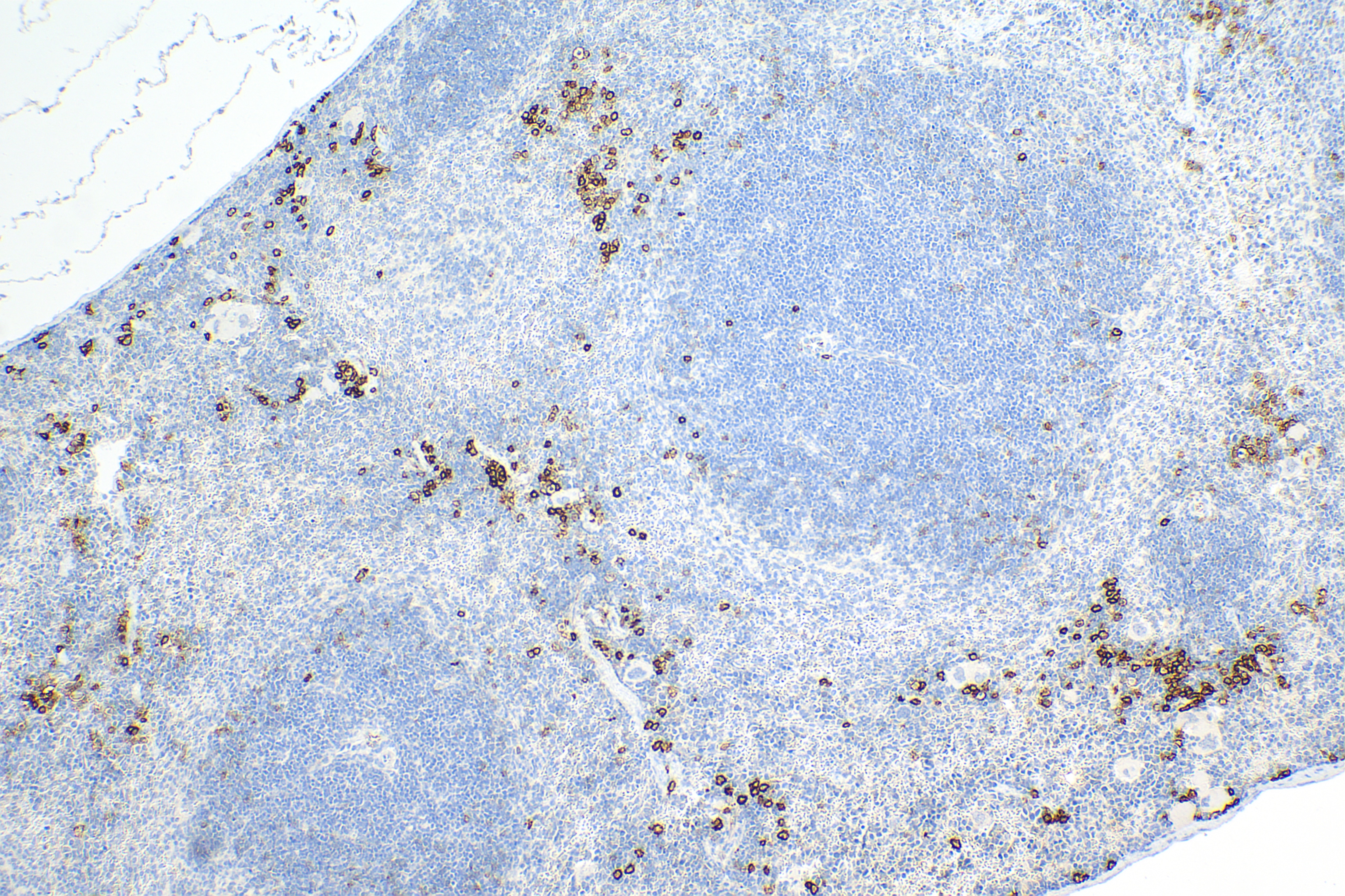 Immunohistochemistry (IHC) staining of mouse spleen tissue using Syndecan-1/CD138 Recombinant antibody (84069-8-RR)