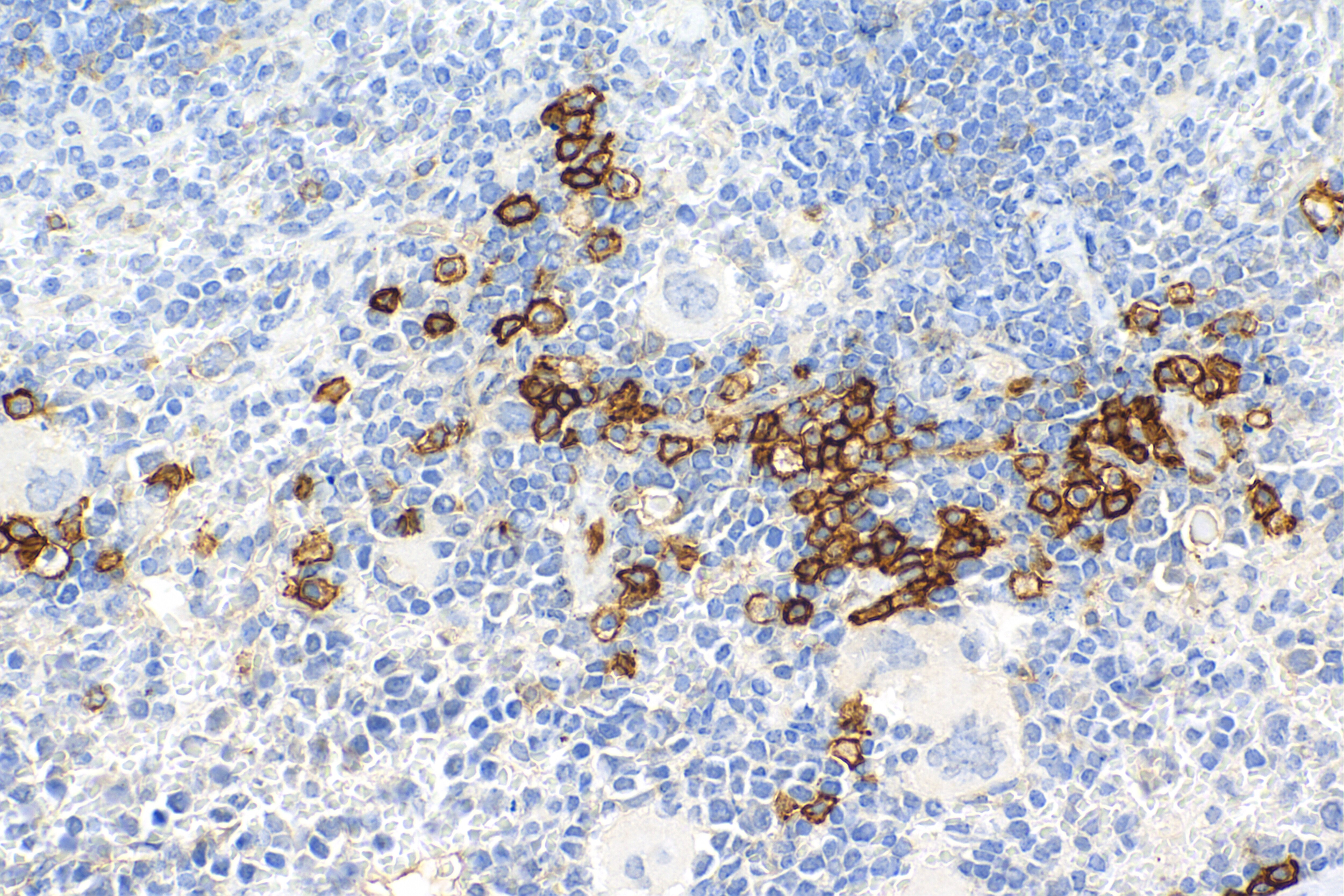 Immunohistochemistry (IHC) staining of mouse spleen tissue using Syndecan-1/CD138 Recombinant antibody (84069-8-RR)