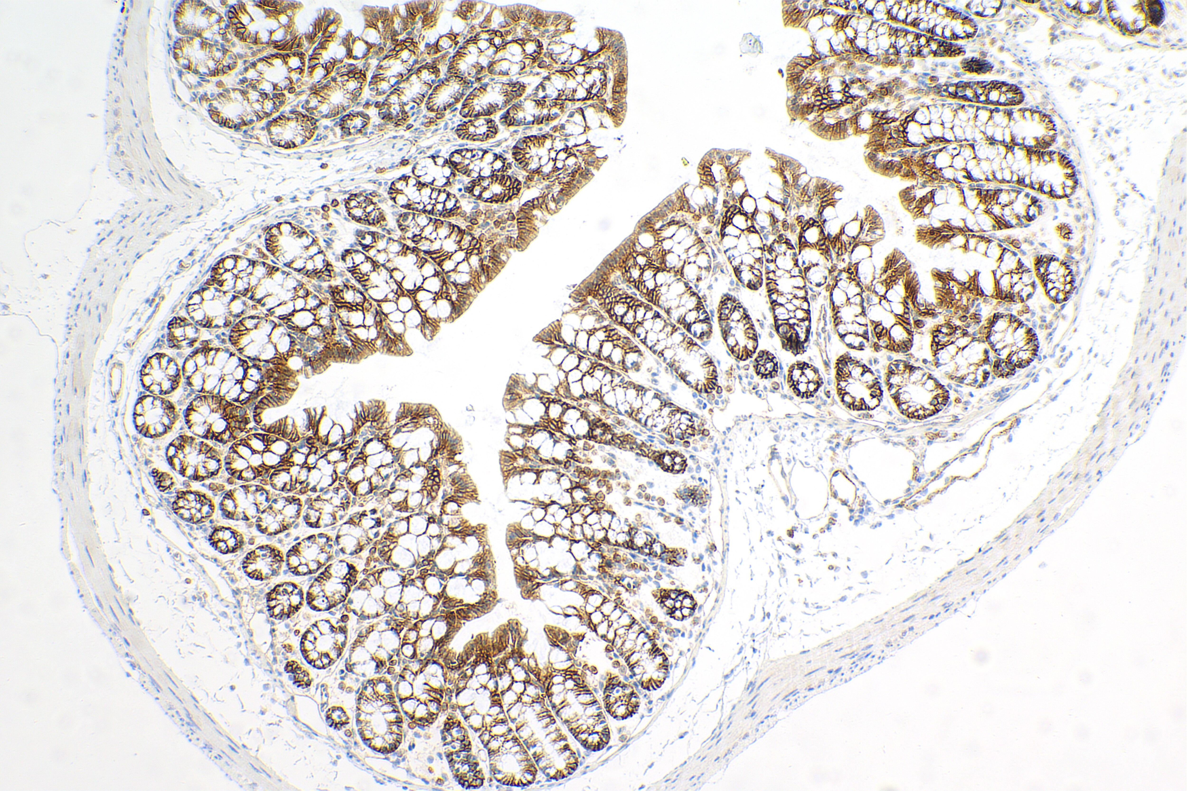 Immunohistochemistry (IHC) staining of mouse colon tissue using Syndecan-1/CD138 Recombinant antibody (84069-8-RR)