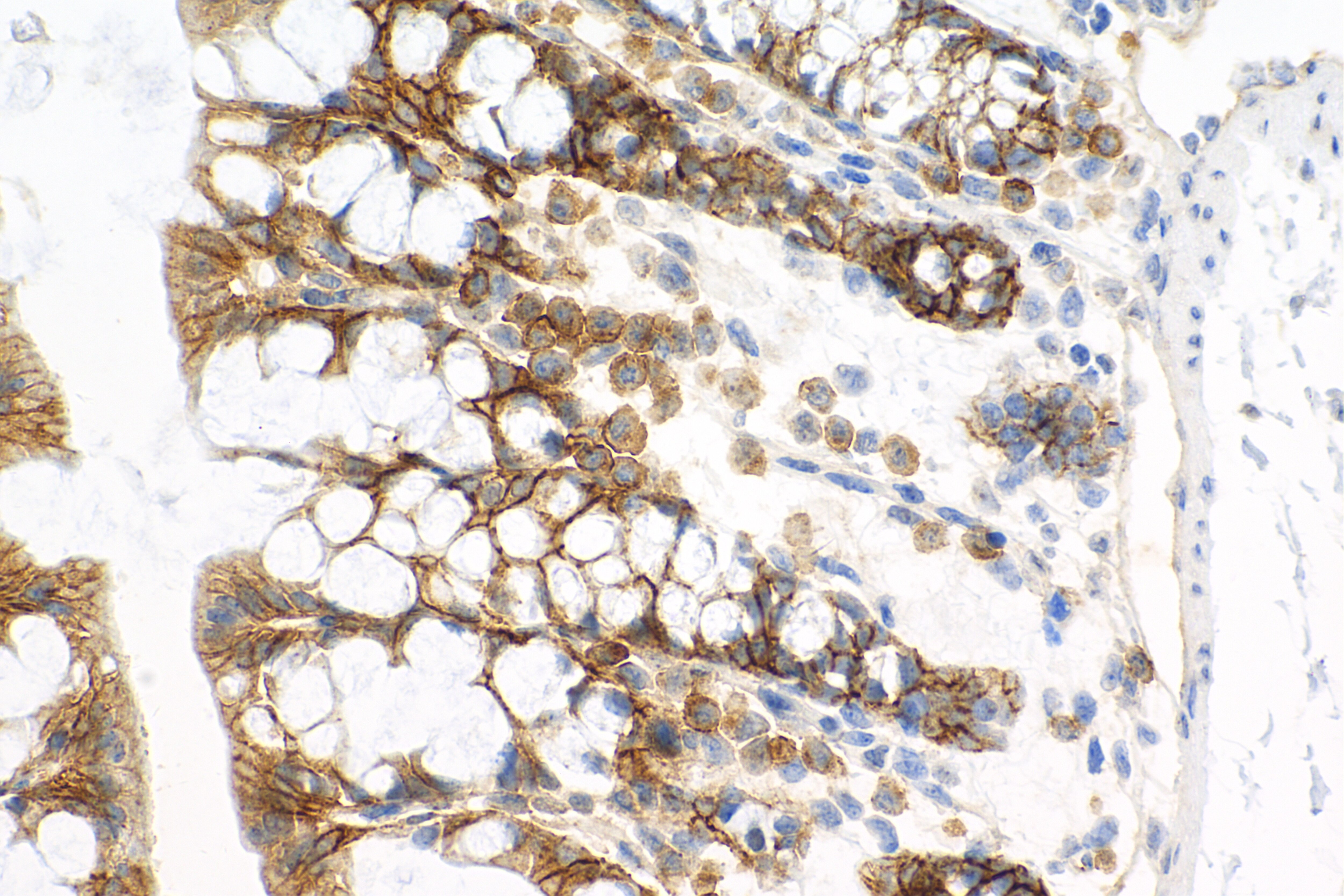 Immunohistochemistry (IHC) staining of mouse colon tissue using Syndecan-1/CD138 Recombinant antibody (84069-8-RR)