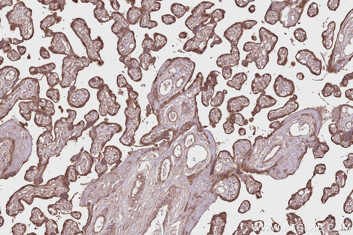 IHC staining of human placenta using 27749-1-AP Immunohistochemistry (IHC) staining of human placenta tissue using Syndetin/CCDC132 Polyclonal antibody (27749-1-AP)