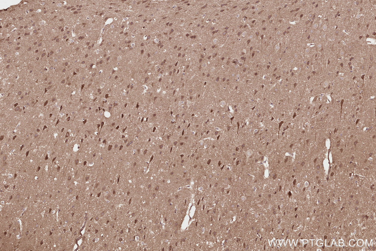 IHC staining of mouse brain using 27749-1-AP Immunohistochemistry (IHC) staining of mouse brain tissue using Syndetin/CCDC132 Polyclonal antibody (27749-1-AP)