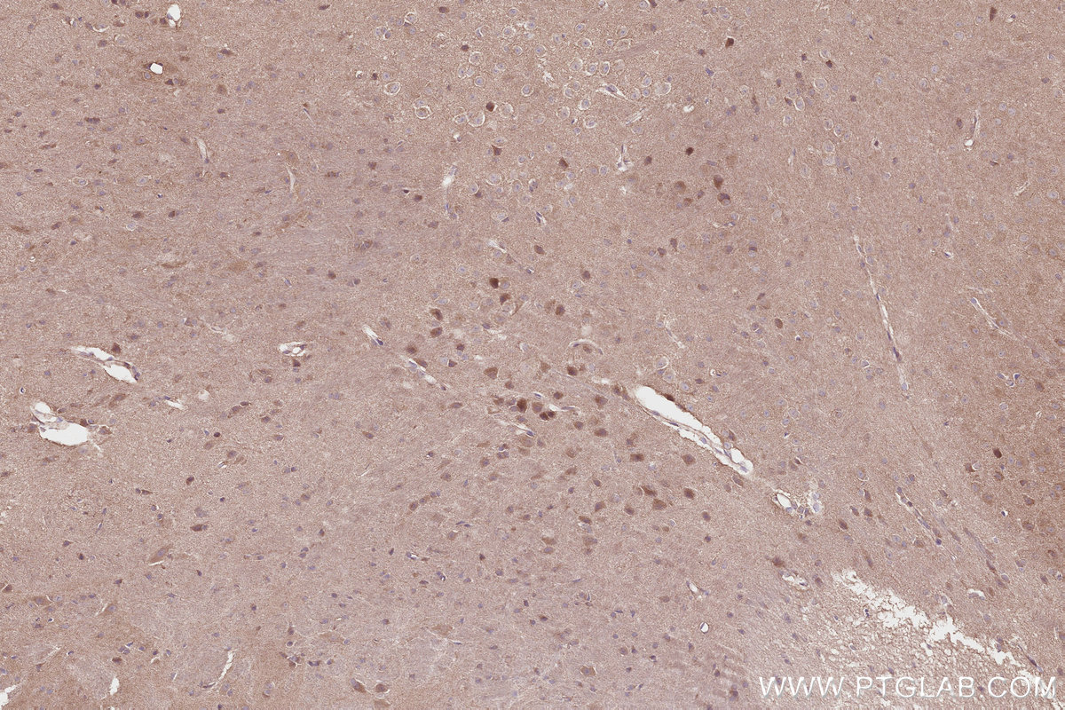IHC staining of mouse brain using 27749-1-AP Immunohistochemistry (IHC) staining of mouse brain tissue using Syndetin/CCDC132 Polyclonal antibody (27749-1-AP)