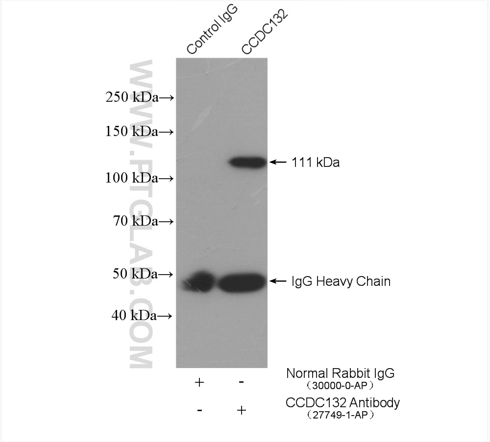 Immunoprecipitation (IP) experiment of mouse brain tissue using Syndetin/CCDC132 Polyclonal antibody (27749-1-AP)